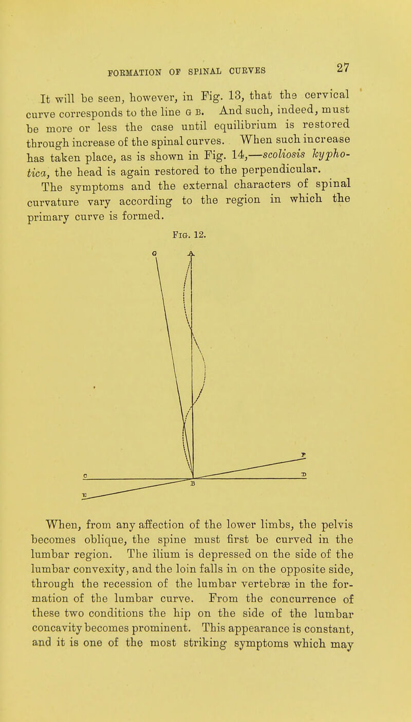 It will be seen, however, in Fig. 13, that the cervical curve corresponds to the line g b. And such, indeed, must be more or less the case until equilibrium is restored through increase of the spinal curves. When such increase has taken place, as is shown in Fig. 14,—scoliosis hypho- tica, the head is again restored to the perpendicular. The symptoms and the external characters of spinal curvature vary according to the region in which the primary curve is formed. Fig. 12. When, from any affection of the lower limbs, the pelvis becomes oblique, the spine must first be curved in the lumbar region. The ilium is depressed on the side of the lumbar convexity, and the loin falls in on the opposite side, through the recession of the lumbar vertebrae in the for- mation of the lumbar curve. From the concurrence of these two conditions the hip on the side of the lumbar concavity becomes prominent. This appearance is constant, and it is one of the most striking symptoms which may
