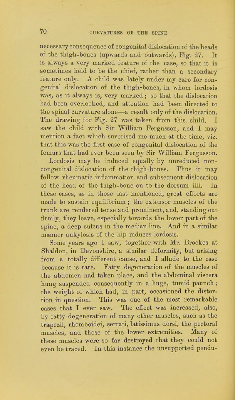 necessary consequence of congenital dislocation of the heads of the thigh-bones (upwards and outwards), Fig. 27. It is always a very marked feature of the case, so that it is sometimes held to be the chief, rather than a secondary feature only. A child was lately under my care for con- genital dislocation of the thigh-bones, in whom lordosis was, as it always is, very marked; so that the dislocation had been overlooked, and attention had been directed to the spinal curvature alone—a result only of the dislocation. The drawing for Fig. 27 was taken from this child. I saw the child with Sir William Fergusson, and I may mention a fact which surprised me much at the time, viz. that this was the first case of congenital dislocation of the femurs that had ever been seen by Sir William Fergusson. Lordosis may be induced equally by unreduced non- congenital dislocation of the thigh-bones. Thus it may follow rheumatic inflammation and subsequent dislocation of the head of the thigh-bone on to the dorsum ilii. In these cases, as in those last mentioned, great efforts are made to sustain equilibrium; the extensor muscles of the trunk are rendered tense and prominent, and, standing out firmly, they leave, especially towards the lower part of the spine, a deep sulcus in the median line. And in a similar manner ankylosis of the hip induces lordosis. Some years ago I saw, together with Mr. Brookes at Shaldon, in Devonshire, a similar deformity, but arising from a totally different cause, and I allude to the case because it is rai'e. Fatty degeneration of the muscles of the abdomen had taken place, and the abdominal viscera hung suspended consequently in a huge, tumid paunch; the weight of which had, in part, occasioned the distor- tion in question. This was one of the most remarkable cases that I ever saw. The effect was increased, also, by fatty degeneration of many other muscles, such as the trapezii, rhomboidei, serrati, latissimus dorsi, the pectoral muscles, and those of the lower extremities. Many of these muscles were so far destroyed that they could not even be traced. In this instance the unsupported pendu-