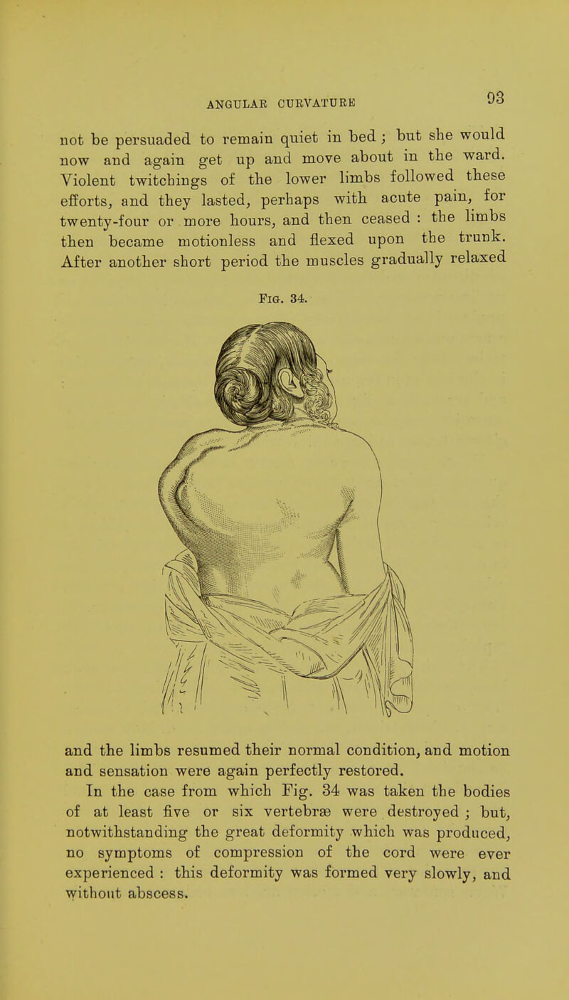 not be persuaded to remain quiet in bed ; but she would now and again get up and move about in the ward. Violent twitchings of the lower limbs followed these efforts, and they lasted, perhaps with acute pain, for twenty-four or more hours, and then ceased : the limbs then became motionless and flexed upon the trunk. After another short period the muscles gradually relaxed Fig. 34. and the limbs resumed their normal condition, and. motion and sensation were again perfectly restored. In the case from which Fig. 34 was taken the bodies of at least five or six vertebrae were destroyed j but, notwithstanding the great deformity which was produced, no symptoms of compression of the cord were ever experienced : this deformity was formed very slowly, and without abscess.