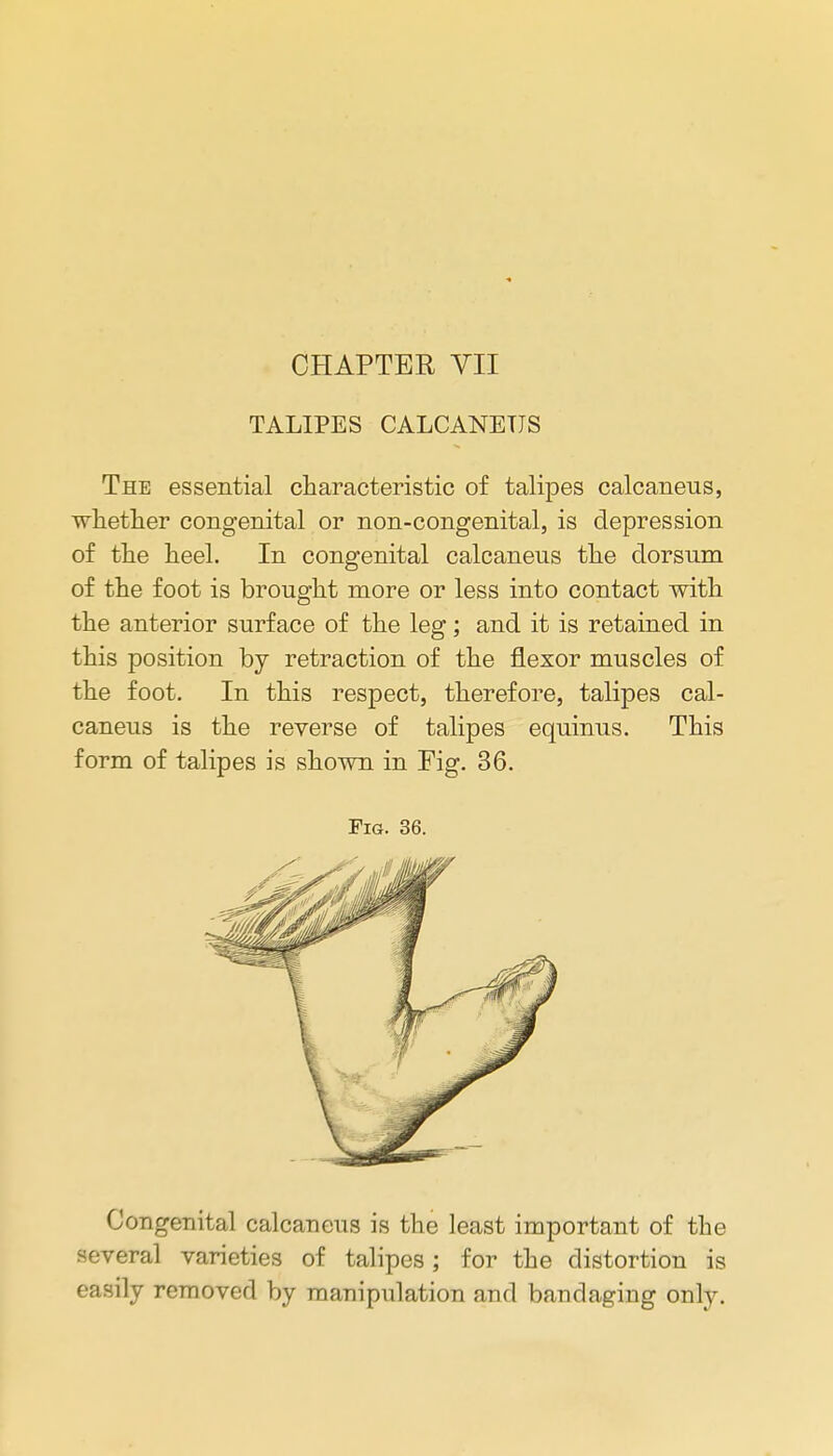 CHAPTER VII TALIPES CALCANEUS The essential characteristic of talipes calcaneus, whether congenital or non-congenital, is depression of the heel. In congenital calcaneus the dorsum of the foot is brought more or less into contact with the anterior surface of the leg; and it is retained in this position by retraction of the flexor muscles of the foot. In this respect, therefore, talipes cal- caneus is the reverse of talipes equinus. This form of talipes is shown in Fig. 36. Fig. 36. Congenital calcaneus is the least important of the several varieties of talipes; for the distortion is easily removed by manipulation and bandaging only.