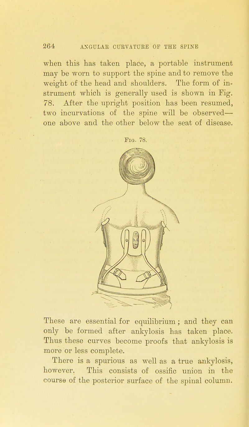 when this has taken place, a portable instrument may be worn to support the spine and to remove the weight of the head and shoulders. The form of in- strument which is generally used is shown in Fig. 78. After the upright position has been resumed, two incurvations of the spine will be observed— one above and the other below the seat of disease. Fig. 78. These are essential for equilibrium; and they can only be formed after ankylosis has taken place. Thus these curves become proofs that ankylosis is more or less complete. There is a spurious as well as a true ankylosis, however. This consists of ossific union in the course of the posterior surface of the spinal column.