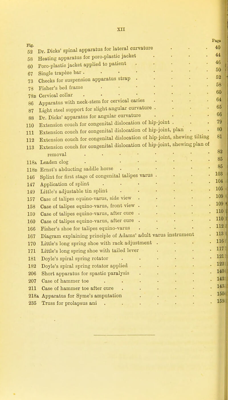 52* Dr. Dicks' spinal apparatus for lateral curvature 58 Heating apparatus for poro-plastic jacket 60 Poro-plastio jacket applied to patient 67 Single trapeze bar . 73 Checks for suspension apparatus strap 78 Fisher's bed frame 78b Cervical collar 86 Apparatus with neck-stem for cervical caries . 87 Light steel support for slight angular curvature . 88 Dr. Dicks' apparatus for angular curvature 110 Extension couch for congenital dislocation of hip-joint 111 Extension couch for congenital dislocation of hip-joint, plan 112 Extension couch for congenital dislocation of hip-joint, shewing tilting 113 Extension couch for congenital dislocation of hip-joint, shewing plan of removal 118a Leaden clog 118b Ernst's abducting saddle horse . 146 SpUnt for first stage of congenital talipes 147 Application of spUnt 149 Little's adjustable tin splint 157 Case of taUpes equino-varus, side view 158 Case of tahpes equino-varus, front view 159 Case of talipes equino-varus, after cure 160 Case of taUpes equino-varus, after cure 166 Fisher's shoe for talipes equino-varus 167 Diagram explaining principle of Adams' adult varus instrument 170 Little's long spring shoe with rack adjustment 171 Little's long spring shoe with tailed lever 181 Doyle's spiral spring rotator 182 Doyle's spiral spring rotator applied 206 Short apparatus for spastic paralysis 207 Case of hammer toe 211 Case of hammer toe after cure 218a Apparatus for Syme's amputation 235 Truss for prolapsus ani 40 44 40 50 52 58 60 64 65 66 79 80 81 varus