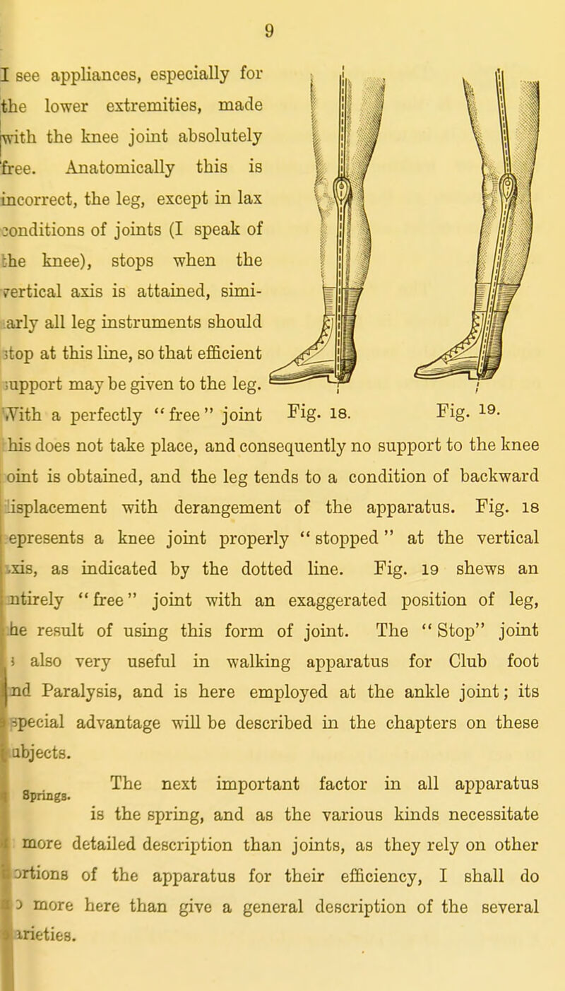 I see appliances, especially for the lower extremities, made |with the knee joint absolutely free. Anatomically this is incorrect, the leg, except in lax conditions of joints (I speak of the knee), stops when the fertical axis is attained, simi- larly all leg instruments should itop at this line, so that efficient support may be given to the leg. With a perfectly  free  joint Fig- 18. Fig. 19. . his does not take place, and consequently no support to the knee oint is obtained, and the leg tends to a condition of backward lisplacement with derangement of the apparatus. Fig. 18 epresents a knee joint properly  stopped at the vertical ixis, as indicated by the dotted line. Fig. 19 shews an jntirely  free joint with an exaggerated position of leg, iie result of using this form of joint. The  Stop joint } also very useful in walking apparatus for Club foot md Paralysis, and is here employed at the ankle joint; its ppecial advantage will be described in the chapters on these labjects. : more detailed description than joints, as they rely on other ortions of the apparatus for their efficiency, I shall do D more here than give a general description of the several ttrieties. Springs. The next important factor in all apparatus is the spring, and as the various kinds necessitate