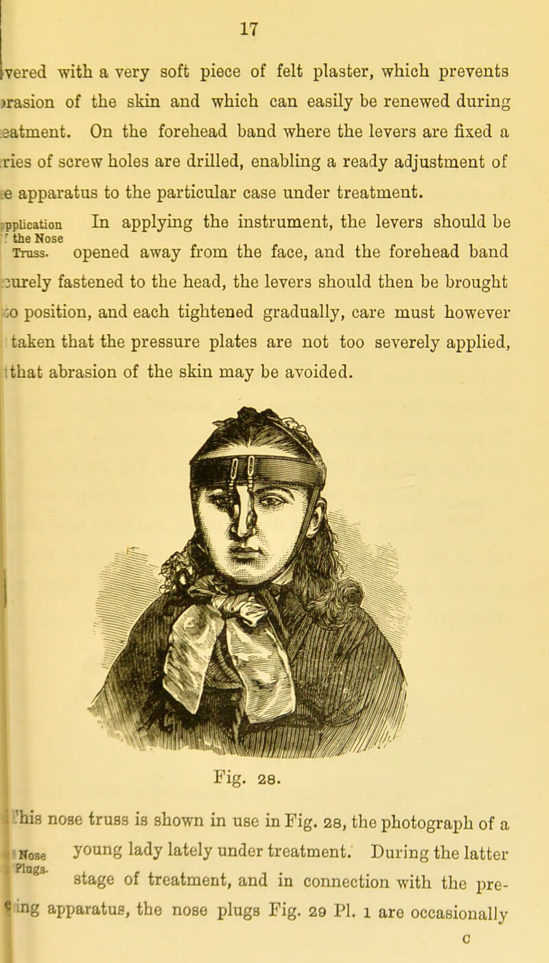 vered with a very soft piece of felt plaster, which prevents jrasion of the skin and which can easily be renewed during isatment. On the forehead band where the levers are fixed a •ries of screw holes are drilled, enabling a ready adjustment of £6 apparatus to the particular case under treatment. ppiication In applying the instrument, the levers should be : the Nose Truss, opened away from the face, and the forehead band :3urely fastened to the head, the levers should then be brought ;^:o position, and each tightened gradually, care must however i taken that the pressure plates are not too severely applied, •that abrasion of the skin may be avoided. Fig. 28 his nose truss is shown in use in Fig. 28, the photograph of a Nose young lady lately under treatment. During the latter stage of treatment, and in connection with the pre- «ing apparatus, the nose plugs Fig. 29 PL i are occasionally
