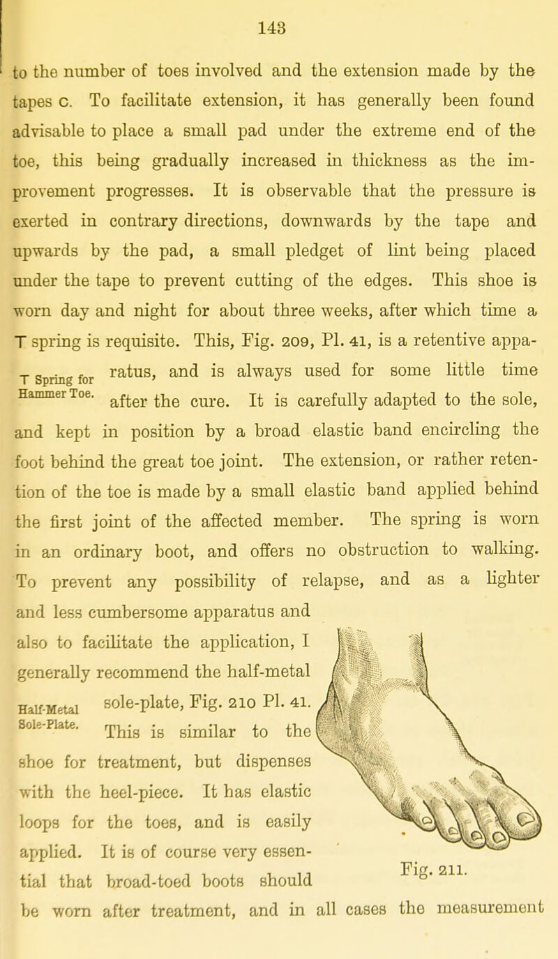 to the number of toes involved and the extension made by the tapes c. To facilitate extension, it has generally been found advisable to place a small pad under the extreme end of the toe, this being gradually increased in thickness as the im- provement progresses. It is observable that the pressure is exerted in contrary directions, downwards by the tape and upwards by the pad, a small jjledget of lint being placed under the tape to prevent cutting of the edges. This shoe is worn day and night for about three weeks, after which time a T spring is requisite. This, Fig. 209, PI. 41, is a retentive appa- T Spring for ^atus, and is always used for some little time Hammer Toe. ^^^^ ^-^^ ^^^^^ Carefully adapted to the sole, and kept in position by a broad elastic band encircling the foot behind the great toe joint. The extension, or rather reten- tion of the toe is made by a small elastic band applied behind tlie first joint of the affected member. The spring is worn in an ordinary boot, and offers no obstruction to walking. To prevent any possibility of relapse, and as a Hghter and less cumbersome apparatus and also to facilitate the application, I generally recommend the half-metal Half-Metal sole-plate. Fig. 210 PI. 41. Sole-Plate. rpj^-g ^^^^-^^^ ^he I shoe for treatment, but dispenses with the heel-piece. It has elastic loops for the toes, and is easily applied. It is of course very essen- tial that broad-toed boots should be worn after treatment, and in all cases the measurement