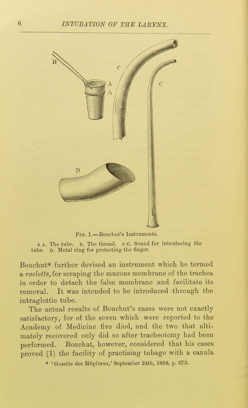 Fig. 1.—Bouchut's Instruments. A A. The tube. b. The thread, c c. Sound for introducing the tube. D. Metal ring for protecting the finger. Bouchut* further devised an instrument which he termed a raclette, for scraping the mucous membrane of the trachea in order to detach the false membrane and facilitate its removal. It was intended to be introduced through the intraglottic tube. The actual results of Bouchut's cases were not exactly- satisfactory, for of the seven which were reported to the Academy of Medicine five died, and the two that ulti- mately recovered only did so after tracheotomy had been performed. Bouchut, however, considei-ed that his cases proved (1) the facility of practising tubage with a canula * < Gazette des Hopitaux/ September 24th, 1858, p. 673.