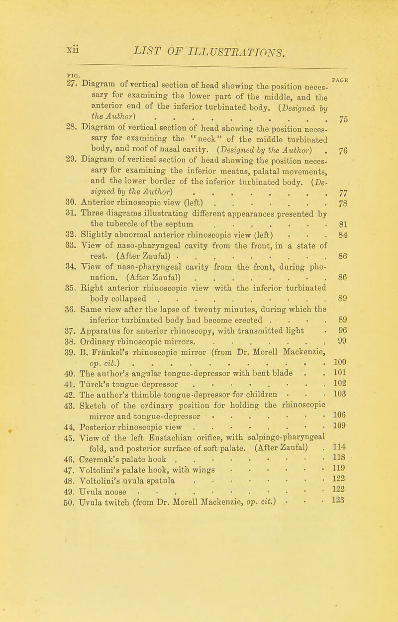FIG. 27. Diagram of vertical section of head showing the position neces- ^ sary for examining the lower part of the middle, and the anterior end of the inferior turbinated body. {Designed by the Author) 28. Diagram of vertical section of head showing the position neces- sary for examining the neck of the middle turbinated body, and roof of nasal cavity. (Designed by the Author) . 76 29. Diagram of vertical section of head showing the position neces- sary for examining the inferior meatus, palatal movements, and the lower border of the inferior turbinated body. {De- signed by the Author) 77 30. Anterior rhinoscopic view (left) . . . . . . .78 31. Throe diagrams illustrating different appearances presented by the tubercle of the septum , 81 32. Slightly abnormal anterior rhinoscopic view (left) ■ • . 84 33. View of naso-pbaryngeal cavity from the front, in a state of rest. (After Zaufal) ......... 86 34. View of naso-pharyngeal cavity from the front, during pho- nation. (After Zaufal) . . . . . . . .86 35. Eight anterior rhinoscopic view with the inferior turbinated body collapsed 89 36. Same view after the lapse of twenty minutes, during which the inferior turbinated body had become erected .... 89 37. Apparatus for anterior rhinoscopy, with transmitted light • 96 38. Ordinary rhinoscopic mirrors. ....... 99 39. B. Frankel's rhinoscopic mirror (from Dr. Morell Mackenzie, op. cit.) 100 40. The author's angular tongue-depressor with bent blade . . 101 41. Tiirck's tongue-depressor 102 42. The author's thimble tongue-depressor for children • . • 103 43. Sketch of the ordinary position for holding the rhinoscopic mirror and tongue-depressor ....... 106 44. Posterior rhinoscopic view 109 45. View of the left Eustachian orifice, with salpingo-pharyngeal fold, and posterior surface of soft palate. (After Zaufal) . 114 46. Czermak's palate hook . 118 47. Voltolini's palate hook, with wings 119 48. Voltolini's uvula spatula 122 49. Uvula noose ^22 50. Uvula twitch (from Dr. Morell Mackenzie, op. cit.) • • .123