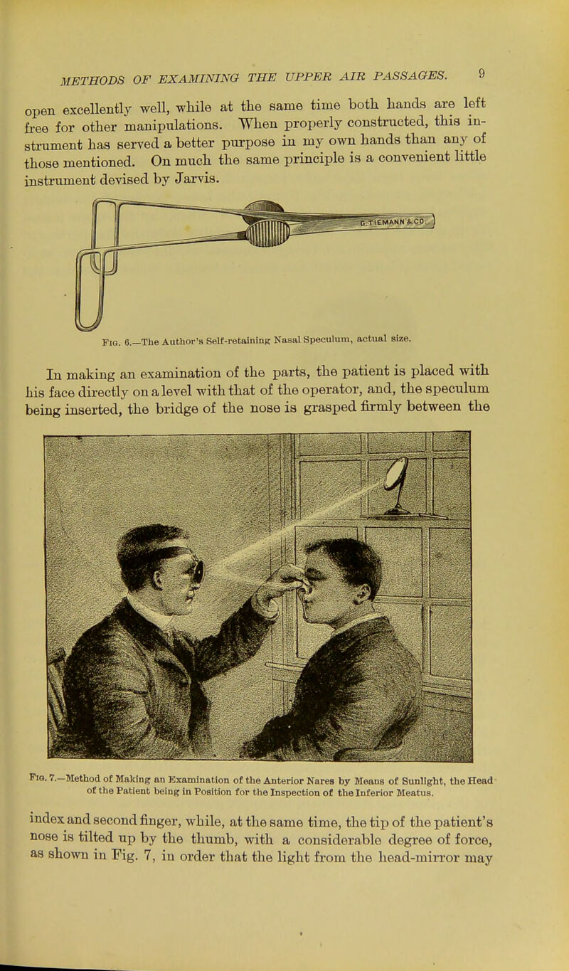 open excellently well, while at the same time both hands are left free for other manipulations. When properly constructed, this in- strument has served a better purpose in my own hands than any of those mentioned. On much the same principle is a convenient little instrument devised by Jarvis. Fig. 6.—The Author's Self-retainjnK Nasal Speculum, actual size. In making an examination of the parts, the patient is placed with his face directly on a level with that of the operator, and, the speculum being inserted, the bridge of the nose is grasped firmly between the Fig. 7.-Method of Making an Kxamination of the Anterior Nares by Means of Sunlight, the Head- of the Patient being In Position for the Inspection of the Interior Meatus. index and second finger, while, at the same time, the tip of the patient's nose is tilted up by the thumb, with a considerable degree of force, as shown in Fig. 7, in order that the light from the head-mirror may