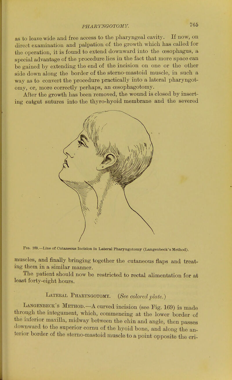 PHABYNQOTOMY. 766 as to leave wide and free access to the pharyngeal cavity. If now, on direct examination and palpation of the growth which has called for the operation, it is found to extend downward into the oesophagus, a special advantage of the procedure lies in the fact that more space can be gained by extending the end of the incision on one or the other side down along the border of the sterno-mastoid muscle, in such a way as to convert the procedure practically into a lateral pharyngot- omy, or, more correctly perhaps, an cesophagotomy. After the growth has been removed, the wound is closed by insert- ing catgut sutures into the thyro-hyoid membrane and the severed Fio. 169.—Line of Cutaneous Incision in Lateral Phaiyngotomy OC^angenbeclc's Method). muscles, and finally bringing together the cutaneous flaps and treat- ing them in a similar manner. The patient should now be restricted to rectal alimentation for at least forty-eight hours. Lateral Phaetngotomy. (^S'ee colored plate.) Langenbeok's Method.—a curved incision (see Fig. 169) is made through the integument, which, commencing at the lower border of the inferior maxiUa, midway between the chin and angle, then passes downward to the superior cornu of the hyoid bone, and along the an- terior border of the sterno-mastoid muscle to a point opposite the cri-