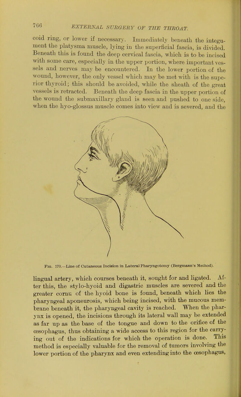 coid ring, or lower if necessary. Immediately beneath tlie integu- ment the platysma muscle, lying in the superficial fascia, is divided. Beneath this is found the deep cervical fascia, which is to be incised with some care, especially in the upper portion, where important ves- sels and nerves may be encountered. In the lower portion of the wound, however, the only vessel which may be met with is the supe- rior thyroid; this should be avoided, while the sheath of the great vessels is retracted. Beneath the deep fascia in the upper portion of the wound the submaxillary gland is seen and pushed to one side, when the hyo-glossus muscle comes into view and is severed, and the Fig. 170.—Line of Cutaneous Incision in Lateral Pharyngotomy (Bergmann's Method). lingual artery, which courses beneath it, sought for and ligated. Af- ter this, the stylo-hyoid and digastric muscles are severed and the greater comu of the hyoid bone is found, beneath which lies the pharyngeal aponeurosis, which being incised, with the mucous mem- brane beneath it, the pharyngeal cavity is reached. When the phar- ynx is opened, the incisions through its lateral wall may be extended as far up as the base of the tongue and down to the orifice of the oesophagus, thus obtaining a wide access to this region for the carry- ing out of the indications for which the operation is done. This method is especially valuable for the removal of tumors involving the lower portion of the pharynx and even extending into the oesophagus,