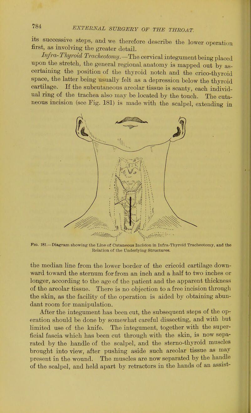 its successive steps, and we therefore describe the lower operation first, as involving the greater detail. Infra^ Thyroid Tracheotomy.—The cervical integument being placed upon the stretch, the general regional anatomy is mapped out by as- certaining the position of the thyroid notch and the crico-thyroid space, the latter being usually felt as a depression below the thyroid cartilage. If the subcutaneous areolar tissue is scanty, each individ- ual ring of the trachea also may be located by the touch. The cuta- neous incision (see Fig. 181) is made with the scalpel, extending in Pig. J81.—Diagram showing tlie Line of Cutaneous Incision in Infra-Thyroid Tracheotomy, and the Relation of the Underlying Structures. the median line from the lower border of the cricoid cartilage down- ward toward the sternum for from an inch and a half to two inches or longer, according to the age of the patient and the apparent thickness of the areolar tissue. There is no objection to a free incision through the skin, as the facility of the operation is aided by obtaining abun- dant room for manipulation. After the integument has been cut, the subsequent steps of the op- eration should be done by somewhat careful dissecting, and with but limited use of the knife. The integument, together with the super- ficial fascia which has been cut through with the skin, is now sepa- rated by the handle of the scalpel, and the sterno-thyroid muscles brought into view, after pushing aside such areolar tissue as may present in the wound. The muscles are now separated by the handle of the scalpel, and held apart by retractors in the hands of an assist-