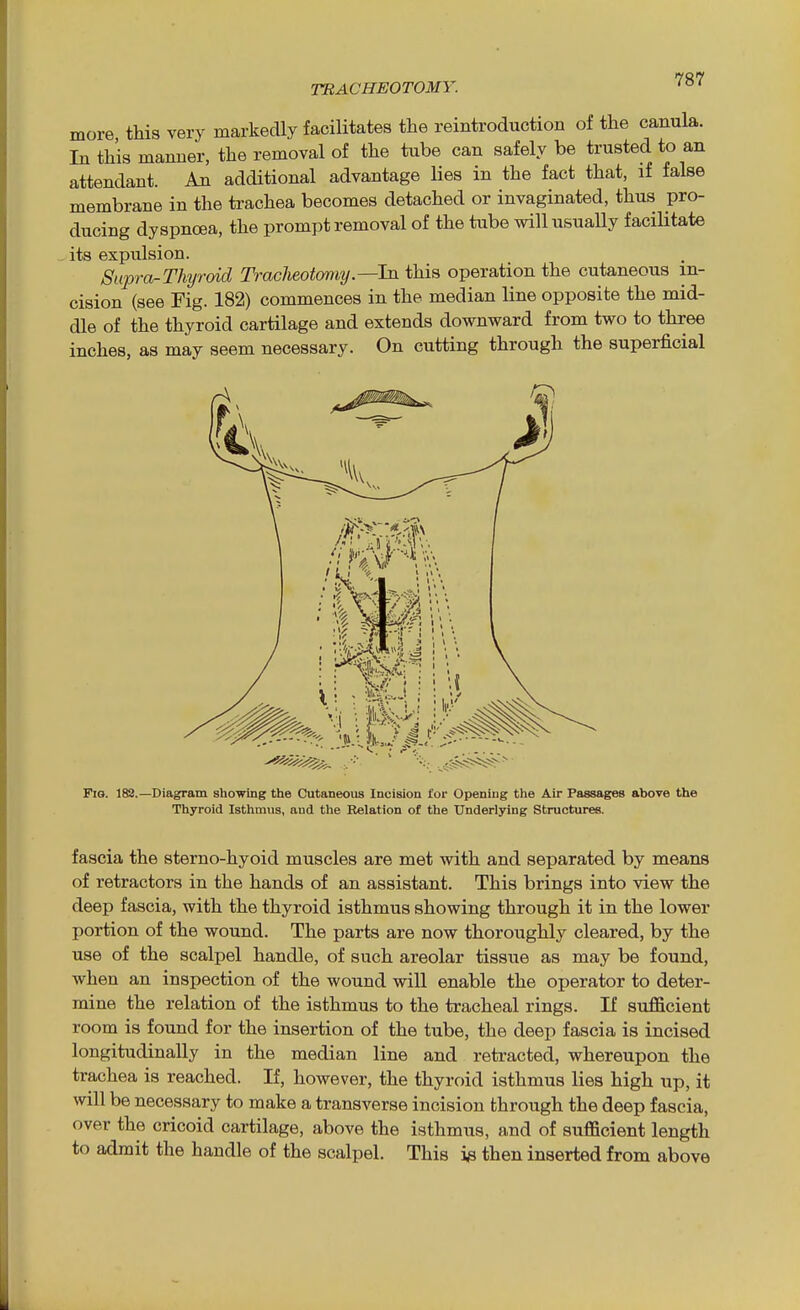 more this very markedly facilitates the reintroduction of the canula. In this manner, the removal of the tube can safely be trusted to an attendant. An additional advantage Hes in the fact that, if false membrane in the trachea becomes detached or invaginated, thus pro- ducing dyspnoea, the prompt removal of the tube will usually facilitate its expulsion. Supra-Thyroid Tracheotomy—'hi this operation the cutaneous in- cision (see Fig. 182) commences in the median line opposite the mid- dle of the thyroid cartilage and extends downward from two to three inches, as may seem necessary. On cutting through the superficial Fig. 182.—Diagram showing the Cutaneous Incision for Opening the Air Passages above the Thyroid Isthmus, and the Relation of the Underlying Structures. fascia the sterno-hyoid muscles are met with and separated by means of retractors in the hands of an assistant. This brings into view the deep fascia, with the thyroid isthmus showing through it in the lower portion of the wound. The parts are now thoroughly cleared, by the use of the scalpel handle, of such areolar tissue as may be found, when an inspection of the wound will enable the operator to deter- mine the relation of the isthmus to the tracheal rings. If sufficient room is found for the insertion of the tube, the deep fascia is incised longitudinally in the median line and retracted, whereupon the trachea is reached. If, however, the thyroid isthmus lies high up, it will be necessary to make a transverse incision through the deep fascia, over the cricoid cartilage, above the isthmus, and of sufficient length to admit the handle of the scalpel. This ig then inserted from above