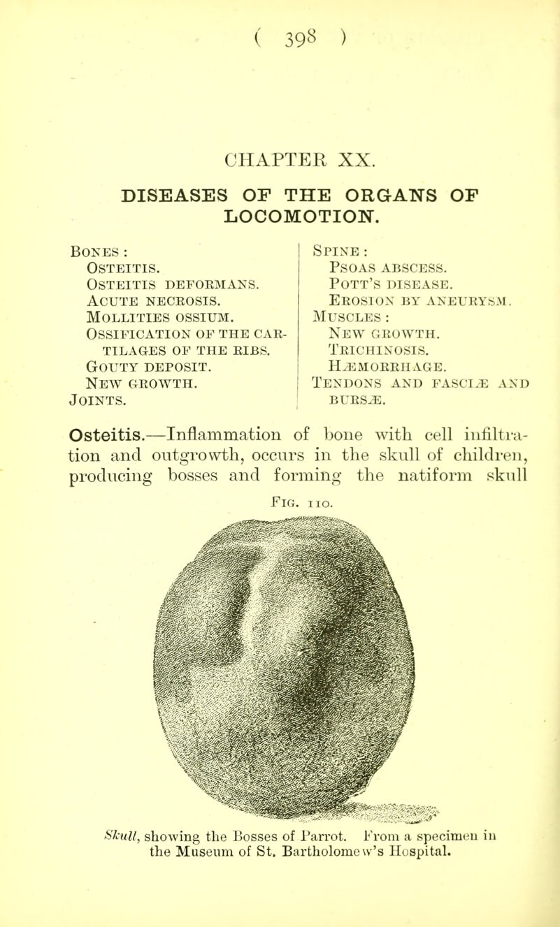 ( 39** ) CHAPTER XX. DISEASES OF THE ORGANS OF LOCOMOTION. Bones: Osteitis. Osteitis defoemans. Acute neceosis. Mollities ossium. Ossification of the cae- tilages of the eibs. Gouty deposit. New geowth. Joints. Spine : Psoas abscess. Pott's disease. Erosion by aneurysm. Muscles : New geowth. Trichinosis. Hemorrhage. Tendons and fascpe and BUES^E. Osteitis.—Inflammation of bone with cell infiltra- tion and outgrowth, occurs in the skull of children, producing bosses and forming the natiform skull Fig. ho. Skull, showing the Bosses of Parrot. From a speciruci the Museum of St. Bartholomew's Hospital.