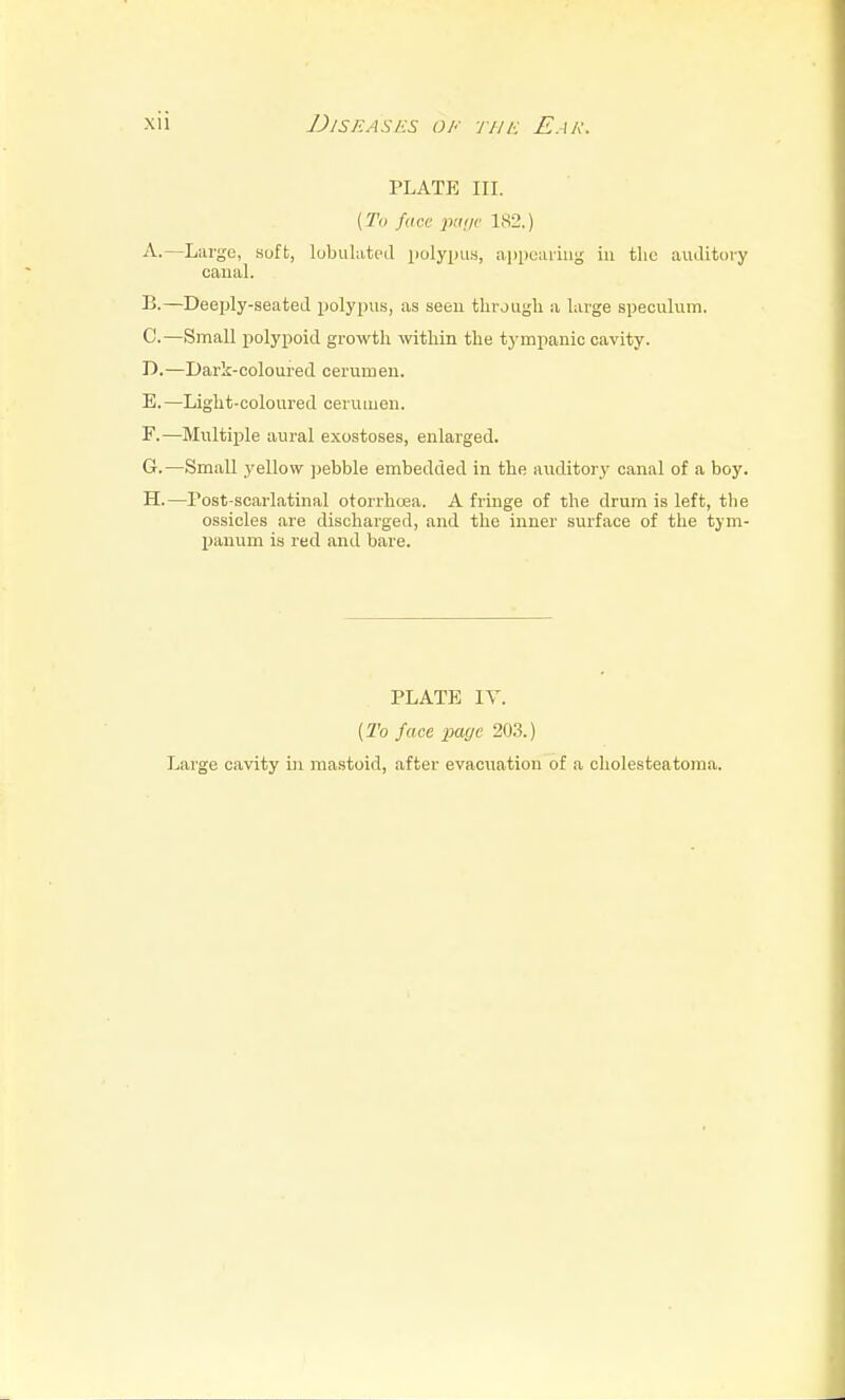 PLATE III. {To face paije 1S2.) A. —Large, soft, lobulatpd polyinis, appciuiiig in the auditory canal. B. —Deeply-seated polypus, as seen tlu-jugli a large speculum. C. —Small polypoid growth within the tympanic cavity. D. —Dark-coloured cerumen. E. —Light-coloured cerumen. F. —Multiple aural exostoses, enlarged. G. —Small yellow ])ebble embedded in the auditory canal of a boy. H. —Post-scarlatinal otorrhcea. A fringe of the drum is left, the ossicles are discharged, and the inner surface of the tym- panum is red and bare. PLATE IT. (To face page 203.) Large cavity in mastoid, after evacuation of a cholesteatoma.