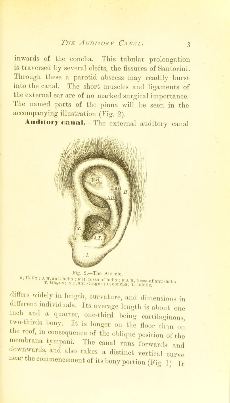 The Auditory Canal. inwards of the concha. This tubular prolongation is traversed by .several clefts, the fissures of Santorini. Through these a parotid abscess may readily burst into the canal. The short muscles and ligaments of the external ear are of no marked surgical importance. The named parts of the pinna will be seen in the accompanying illustration (Fig. 2). Auditory canal—The external auditory canal Fiy- 2.—Tlio Auricle, ir, Helix ; A IT anti-bclix ; r ir, fusea ot helix; r a h, fo»sa of ami heiiv T, IniBUR ; A T, M.ui-tragiiK ; c, concUa ; , lolmle. ''■'-'^''-^ differs widely in length, curvature, and dimensions in different individuals. Its average length is about one inch and a quarter, one-third being cartilngiuous two-thirds bony. Ifc i.s longer on the iioor tlnn on the roof, in consequence of the oblique position of the membrana tympani. The canal runs forwards and downwards, and also takes a distinct vertical curve near the commencement of its bony portion (Fi.r 1) n