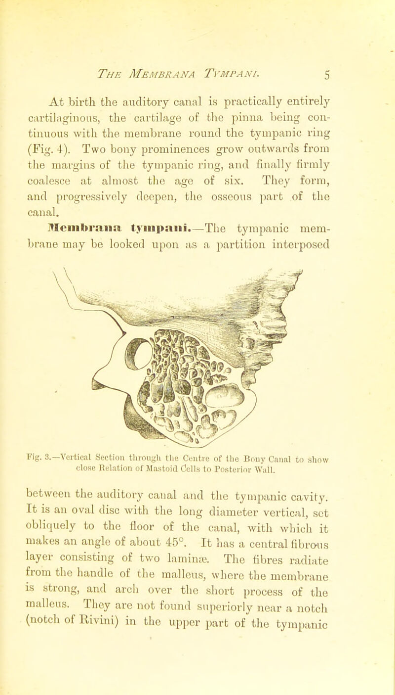 At birth the auditory canal is practically entirely cartilaginous, the cartilage of the pinna being con- tinuous with the membrane round the tympanic ring (Fig. 4). Two bony prominences grow outwards from tlie margins of the tympanic ring, and finally firmly coalesce at almost the age of six. They form, and progi-essively deepen, the osseous part of the canal. Mciiibraim tyiiipniii.—The tympanic mem- brane may be looked upon as a partition interposed Fig. 3.—Vci'tioal Section tlirougli tlie Centre nf llie Bouy Canal to .show clo.se Relation of Mastoid C'clls to Posterloi' Wall. between the auditory canal and the tympanic cavity. It is an oval disc witli the long diameter vertical, set obliquely to the floor of the canal, with which it makes an angle of about 45°. It has a central fibrwis layer con.sisting of two lamina3. The fibres radiate from the handle of the malleus, where the membrane is strong, and arcli over the short process of the malleus. They arc not found superiorly near a notcli (notch of Rivini) in the upper part of the tympanic