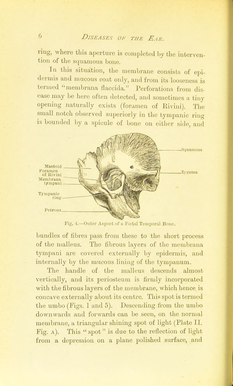ring, where this aperture is completed by the interven- tion of the squamous bone. In this situation, the membrane consists of epi- dermis and mucous coat only, and from its looseness is termed membrana flaccida. Perforations from dis- ease may be liere often detected, and sometimes a tiny opening naturally exists (foramen of Rivini). The small notch observed superiorly in the tympanic ring is bounded by a spicule of bone on eitlicr side, and .Siiuaiiioiis .Zygoma Fig. 4.—Outer Asptict of a Fu;tal Tejiipnnil Bone. bundles of fibres pass from these to the short process of the malleus. The fibrous layers of the membrana tympani are covered externally by epidermis, and internally by the mucous lining of the tympanum. The handle of the malleus descends almost vertically, and its periosteum is firmly incorporated with the fibrous layers of the membrane, which hence is concave externally about its centre. This spot is termed the umbo (Figs. 1 and 5). Descending from tlie umbo downwards and forwards can be seen, on the noruuxl membrane, a triangular shining spot of light (Plate II. Fig. a). This  spot is due to the reflection of light from a depression on a plane polished surface, and