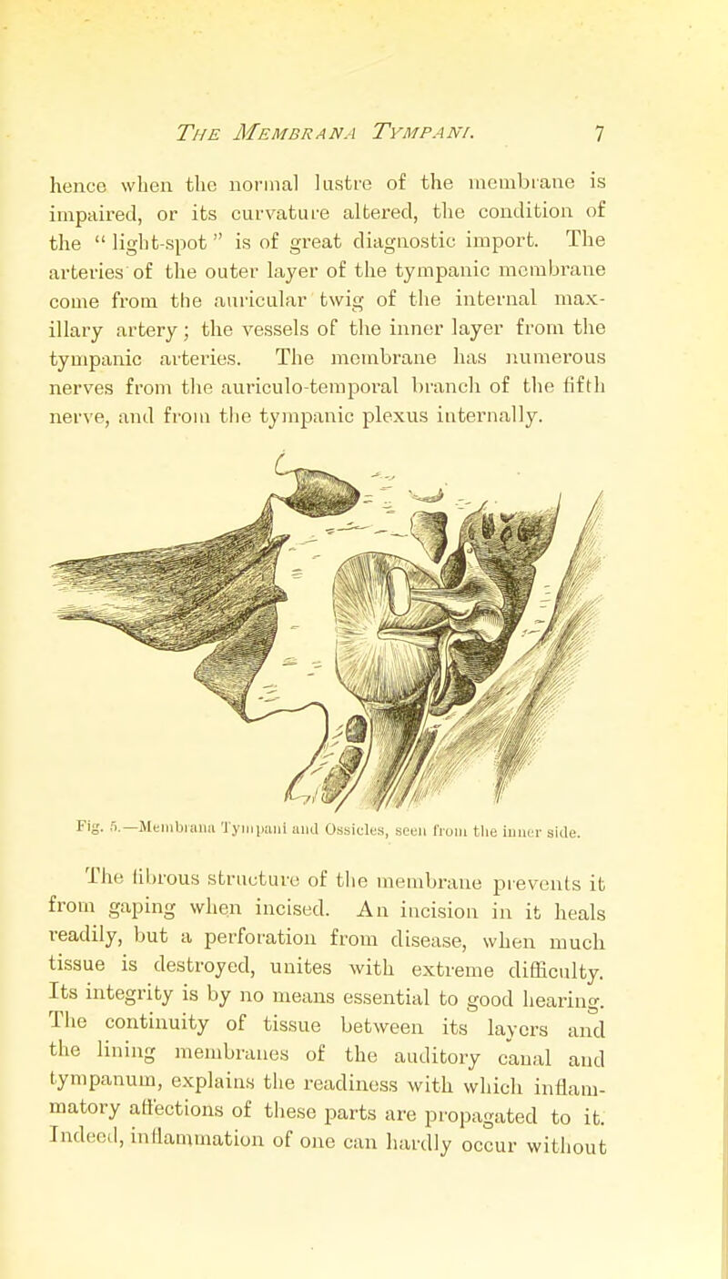 henco when the normal lustre of the membrane is impaired, or its curvature altered, the condition of the  light-spot  is of great diagnostic import. The arteries of the outer layer of the tympanic membrane come from the auricular twig of the internal max- illary artery; the vessels of the inner layer from the tympanic arteries. The membrane has numerous nerves from the auriculo-terapoi'al branch of the fifth nerve, and from the tympanic plexus iuternally. Fig. 0.—Meiiibraiiii 'Jyiiiiuiiii ami Ossicles, seen I'ruiii the iuuer side. The fibrous structure of the membrane prevents it from gaping when incised. An iacisioa in it heals readily, but a perforation from disease, when much tissue is destroyed, unites with extreme difficulty. Its integrity is by no means essential to good hearing. The continuity of tissue between its layers and the lining membranes of the auditory canal and tympanum, explains the readiness with which inflam- matory atlections of these parts are propagated to it. Indeed, inflammation of one can hardly occur without