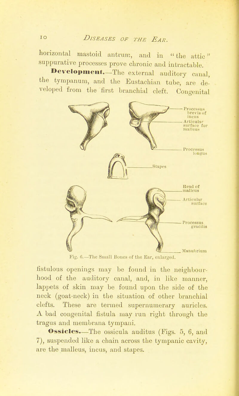 horizontal mastoid anti-um, and in  tlie attic suppurative pi'ocesses prove chronic and intractable. Development—The external auditoiy canal, the tympanum, and the Eustachian tube, are de- veloped from tlie first branchial cleft. Congenital lirevis (if incus Ai-ticular siii'face for ]^.'llletl?^ Processus Icmgus .Stiiiies Hcail of iiialloiis Articiihir surface — Processus gracilis Manuliriuiii Fiij. Ci.—Tlie Small Bones of the Bar, enlargetl. fistulous openings may be found in the neighbour- hood of the auditory canal, and, in like manner, lappets of skin may be found upon the side of the neck (goat-neck) in tbe situation of other branchial clefts. These are termed supernumerary auricles. A bad congenital fistula may run right througli the tragus and membrana tympaui. Ossicles.—The ossicula auditus (Figs. 5, 6, and 7), suspended like a chain across the tympanic cavity, are the malleus, incus, and stapes.