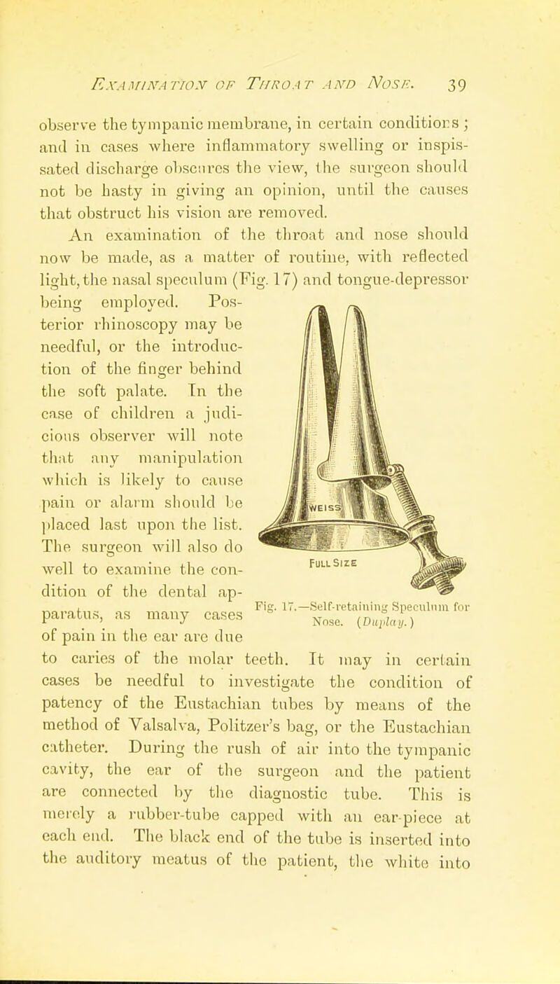 observe the tympanic membrane, in certain conditiors ; and in cases where inflammatory swelling or inspis- sated discharge obscures the view, tlie surgeon should not be hasty in giving an opinion, until the causes that obstruct his vision are removed. An examination of the throat and nose should now be made, as a matter of routine, with reflected light,the nasal speculum (Fig. 17) and tongue-depressor being employed. Pos- terior rhinoscopy may be needful, or the introduc- tion of the finger behind the soft palate. Tn the case of children a judi- cious observer will note that any manipulation which is likely to cause pain or alarm should be placed last upon the list. The surgeon M'ill also do well to examine the con- dition of the dental ap- paratus, as many cases of pain in the ear arc due to caries of the molar teeth. It may in certain cases be needful to investigate the condition of patency of the Eustachian tubes by means of the method of Valsalva, Politzer's bag, or the Eustachian catheter. During the rush of air into the tympanic cavity, the ear of the surgeon and the patient are connected by the diagnostic tube. This is meioly a i-ubber-tube capped with an ear-piece at each end. The black end of the tube is inserted into the auditory meatus of the patient, tlie white into Full Size Fig. IV.—SGlf-retaining Speculum for Nnse. {Duidaij.)