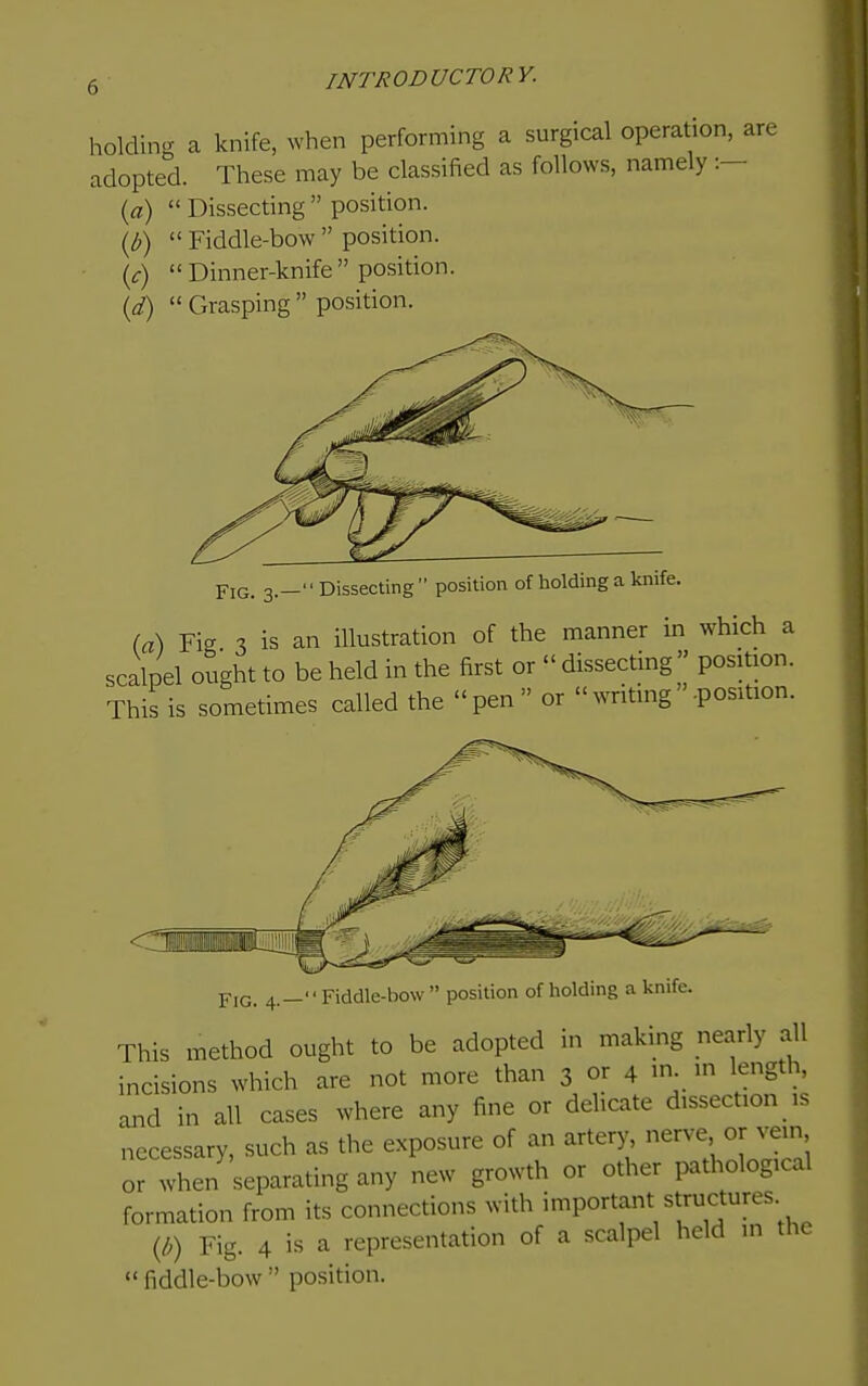 holding a knife, when performing a surgical operation, are adopted. These may be classified as follows, namely :- {a)  Dissecting  position. {b)  Fiddle-bow  position. {c) Dinner-knife position. [d)  Grasping  position. Fig. 3.—Dissecting position of holding a knife. {a\ Fig % is an illustration of the manner m which a scalpel ought to be held in the first or  dissecting  position. This is sometimes called the pen or  writing -position. Fig. 4.—Fiddle-bow position of holding a knife. This method ought to be adopted in makmg nearly all incisions which are not more than 3 or 4 m m length, and in all cases where any fine or delicate dissection is necessary, such as the exposure of an artery, nerve or vein  when separating any new growth or other pathological formation from its connections with important structures {b) Fig. 4 is a representation of a scalpel held in the  fiddle-bow  position.