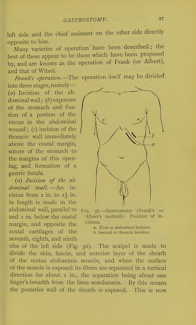 left side and the chief assistant on the other side directly opposite to him. Many varieties of operation' have been described; the best of these appear to be those which have been proposed by, and are known as the operation of Frank (or Albert), and that of Witzel. Fratik's operation.—operation itself may be divided into three stages, namely— {a) Incision of the ab- dominal wall; {b) exposure of the stomach and fixa- tion of a portion of the viscus in the abdominal wound; {c) incision of the thoracic wall immediately above the costal margin, suture of the stomach to the margins of this open- ing, and formation of a gastric fistula. (a) Incision of the ab- dominal zvall. —An in- cision from 2 in. to 2|- in. in length is made in the abdominal wall, parallel to and I in. below the costal margin, and opposite the costal cartilages of the seventh, eighth, and ninth ribs of the left side (Fig. 36). The scalpel is made to divide the skin, fasciae, and anterior layer of the sheath of the rectus abdominis muscle, and when the surface of the muscle is exposed its fibres are separated in a vertical direction for about i in., the separation being about one finger's-breadth from the linea semilunaris. By this means the posterior wall of the sheath is exposed. This is now Fig. 36.—Gastrostomy (Frank's or Albert's method) : Position of in- cisions. a. First or abdominal incision. b. Second or thoracic incision.