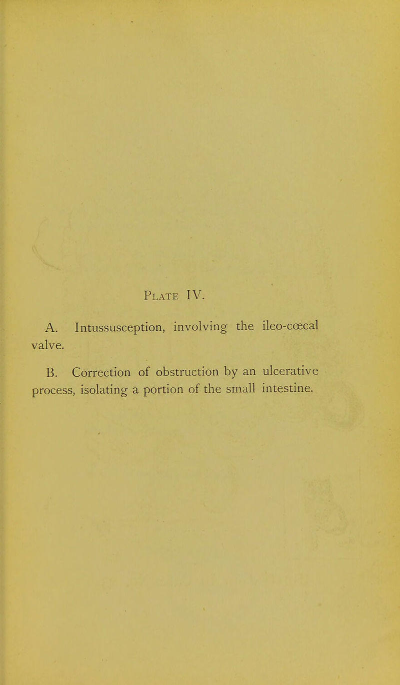 Plate IV. A. Intussusception, involving the ileo-coecal valve. B. Correction of obstruction by an ulcerative process, isolating a portion of the small intestine.