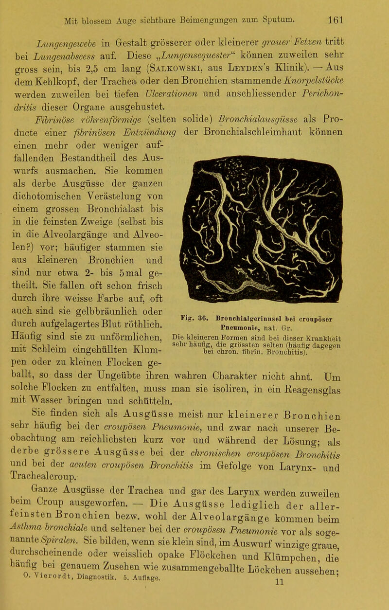 der Bronchialscbleirnhaut können Lungengewebe in Gestalt grösserer oder kleinerer grauer Fetzen tritt bei Lungenabscess auf. Diese „Lungensequester können zuweilen sehr gross sein, bis 2,5 cm lang (Salkowski, aus Leyden's Klinik). — Aus dem Kehlkopf, der Trachea oder den Bronchien stammende Knorpelstücke werden zuweilen bei tiefen Ulcerationen und anschliessender Perichon- dritis dieser Organe ausgehustet. Fibrinöse röhrenförmige (selten solide) Bronchialausgüsse als Pro- ducte einer fibrinösen Entzündung einen mehr oder weniger auf- fallenden Bestandtheil des Aus- wurfs ausmachen. Sie kommen als derbe Ausgüsse der ganzen dichotomischen Verästelung von einem grossen Bronchialast bis in die feinsten Zweige (selbst bis in die Alveolargänge und Alveo- len?) vor; häufiger stammen sie aus kleineren Bronchien und sind nur etwa 2- bis 5 mal ge- theilt. Sie fallen oft schon frisch durch ihre weisse Farbe auf, oft auch sind sie gelbbräunlich oder durch aufgelagertes Blut röthlich. Häufig sind sie zu unförmlichen, mit Schleim eingehüllten Klum- pen oder zu kleinen Flocken ge- ballt, so dass der Ungeübte ihren wahren Charakter nicht ahnt. Um solche Flocken zu entfalten, muss man sie isoliren, in ein Reagensglas mit Wasser bringen und schütteln. Sie finden sich als Ausgüsse meist nur kleinerer Bronchien sehr häufig bei der croupösen Pneumonie, und zwar nach unserer Be- obachtung am reichlichsten kurz vor und während der Lösung; als derbe grössere Ausgüsse bei der chronischen croupösen Bronchitis und bei der acuten croupösen Bronchitis im Gefolge von Larynx- und Trachealcroup. Ganze Ausgüsse der Trachea und gar des Larynx werden zuweilen beim Croup ausgeworfen. — Die Ausgüsse lediglich der aller- femsten Bronchien bezw. wohl der Alveolargänge kommen beim Asthma bronchiale und seltener bei der croupösen Pneumonie vor als soge- nannte Spiralen. Sie büden, wenn sie klein sind, im Auswurf winzige o-raue durchscheinende oder weisslich opake Flöckchen und Klümpchen die häufig bei genauem Zusehen wie zusammengeballte Löckchen aussehen- O. Vierordt, Diagnostik. 5. Auflage. n ' Fig. 36. Bronchialgerimisel bei croupöser Pneumonie, nat. Gr. Die kleineren Formen sind bei dieser Krankheit sehr häufig, die grössten selten (häufig dagegen bei chron. fibrin. Bronchitis).