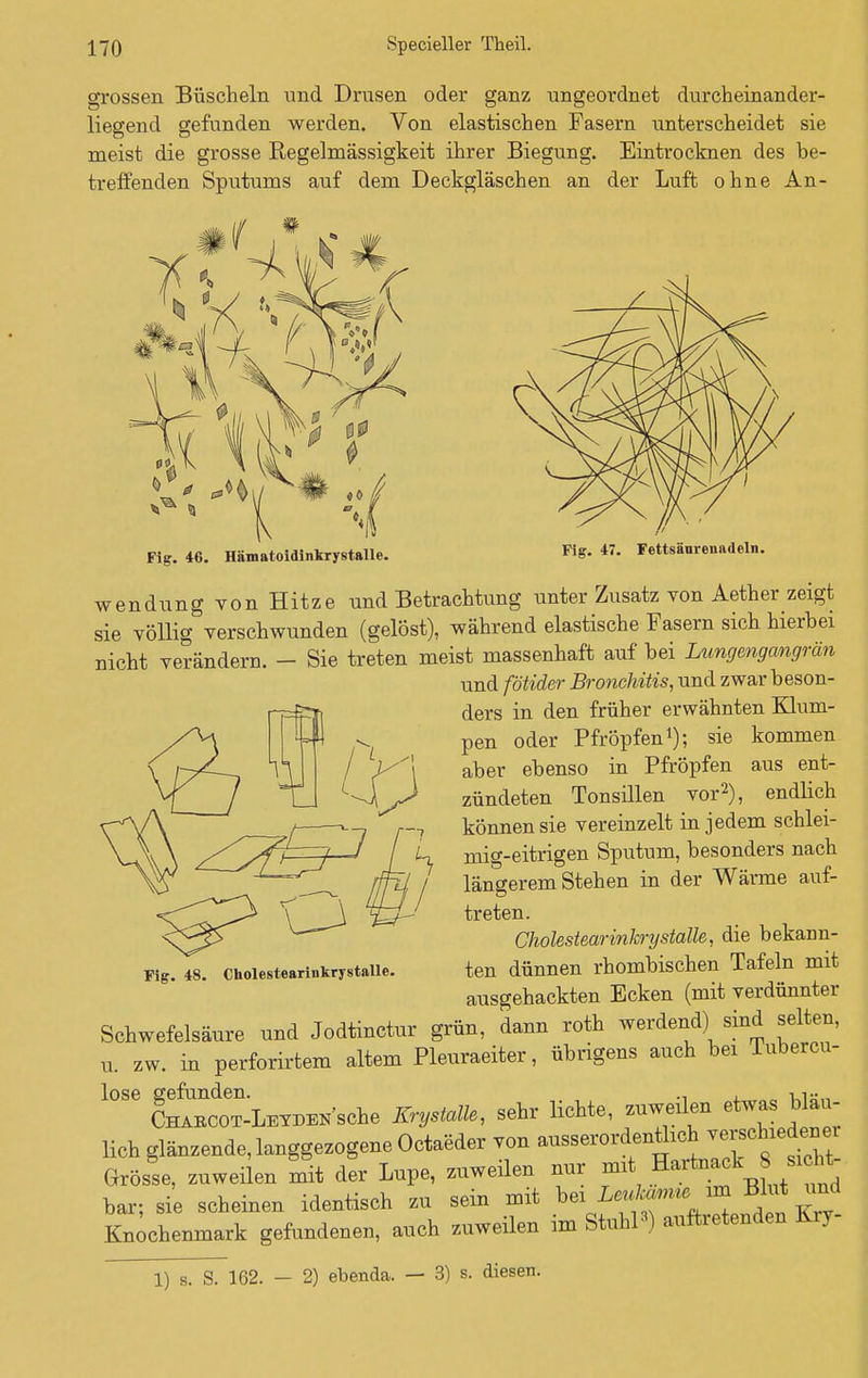 grossen Büscheln und Drusen oder ganz ungeordnet durcheinander- liegend gefunden werden. Von elastischen Fasern unterscheidet sie meist die grosse Regelmässigkeit ihrer Biegung. Eintrocknen des be- treffenden Sputums auf dem Deckgläschen an der Luft ohne An- Fig. 46. Hämatoidinkrystalle. Fig. 4. Fettsänrenadeln. wendung von Hitze und Betrachtung unter Zusatz von Aether zeigt sie völlig verschwunden (gelöst), während elastische Fasern sich hierbei nicht verändern. - Sie treten meist massenhaft auf bei Lungengangrän und fötider Bronchitis, und zwar beson- ders in den früher erwähnten Klum- pen oder Pfropfen1); sie kommen aber ebenso in Pfropfen aus ent- zündeten Tonsillen vor2), endlich können sie vereinzelt in jedem schlei- U mig-eitrigen Sputum, besonders nach längerem Stehen in der Wärme auf- treten. Cholestearinkrystalle, die bekann- ten dünnen rhombischen Tafeln mit ausgehackten Ecken (mit verdünnter Schwefelsäure und Jodtinctur grün, dann roth werdend) sind selten, u. zw. in perforirtem altem Pleuraeiter, übrigens auch bei lubercu- lose gefunden. i1» CHABCOT-LEYDEN'sche Krystalle, sehr lichte, zuweilen etwas blau- lich glänzende, langgezogene Octaeder von ausserordenthch ve-chiedenei Grösse, zuweilen mit der Lupe, zuweilen nur mit Hartaack^8. bar; sie scheinen identisch zu sein mit beil^* » Bkrt und Knochenmark gefundenen, auch zuweilen im StuhP) auftretenden Kry- Fig. 48. Cholestearinkrystalle. 1) s. S. 162. — 2) ebenda. — 3) s. diesen.