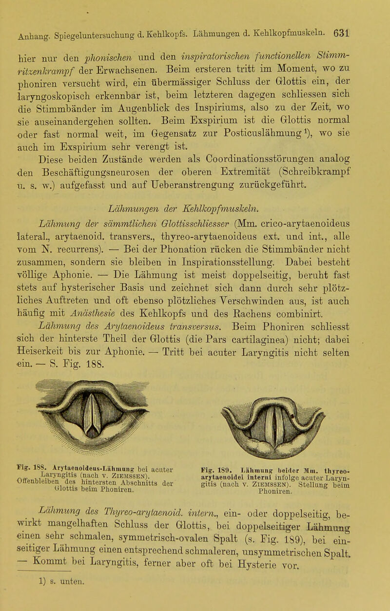 hier nur den phonischen und den inspiratorischen functionellen Stimm- ritxenkrampf der Erwachsenen. Beim ersfceren tritt im Moment, wo zu phoniren versucht wird, ein übermässiger Schluss der Glottis ein, der laryngoskopisch erkennbar ist, beim letzteren dagegen schliessen sich die Stimmbänder im Augenblick des Inspiriums, also zu der Zeit, wo sie auseinandergehen sollten. Beim Exspirium ist die Glottis normal oder fast normal weit, im Gegensatz zur Posticuslähmung wo sie auch im Exspirium sehr verengt ist. Diese beiden Zustände werden als Coordinationsstörungen analog den Beschäftigungsneurosen der oberen Extremität (Schreibkrampf u. s. w.) aufgefasst und auf Ueberanstrengung zurückgeführt. Lähmungen der Kehlkopfmuskeln. Lähmung der sämmtlichen Qlottisschliesser (Mm. crico-arytaenoideus lateral., arytaenoid. transvers., thyreo-arytaenoideus ext. und int., alle vom N. recurrens). — Bei der Phonation rücken die Stimmbänder nicht zusammen, sondern sie bleiben in Inspirationsstellung. Dabei besteht völlige Aphonie. — Die Lähmung ist meist doppelseitig, beruht fast stets auf hysterischer Basis und zeichnet sich dann durch sehr plötz- liches Auftreten und oft ebenso plötzliches Verschwinden aus, ist auch häufig mit Anästhesie des Kehlkopfs und des Rachens combinirt. Lähmung des Arytaenoideus transversus. Beim Phoniren schliesst sich der hinterste Theil der Glottis (die Pars cartilaginea) nicht; dabei Heiserkeit bis zur Aphonie. — Tritt bei acuter Laryngitis nicht selten •ein. — S. Fig. 188. Fig. 1S8. Arytaonoldeus-Lähmung bei acuter naf Laryngitis (nach v. Ziemssen). Offenbleiben des hintersten Abschnitts der Ulottis beim Phoniren. Fig. 189. Lähmung- beider Mm. thyreo- arytaenoidei interni infolge acuter Laryn- gitis (nach v. Ziemssen). Stellung beim Phoniren. Lähmung des Thyreo-arytaenoid. intern., ein- oder doppelseitig, be- wirkt mangelhaften Schluss der Glottis, bei doppelseitiger Lähmung einen sehr schmalen, symmetrisch-ovalen Spalt (s. Fig. 189), bei ein* seitiger Lähmung einen entsprechend schmaleren, unsymmetrischen Spalt. — Kommt bei Laryngitis, ferner aber oft bei Hysterie vor. 1) s. unten.