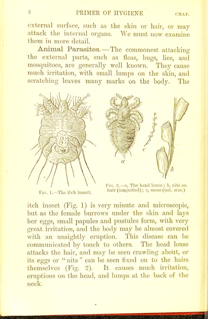 CHA P. external surface, such as the skin or hair, or may attack the internal organs. We must now examine them in more detail. Animal Parasites.—The commonest attacking the external parts, such as fleas, bugs, lice, and mosquitoes, are generally well known. They cause much irritation, with small lumps on the skin, and scratching leaves many marks on the body. The Fia. l.-The itch insect. hair (magnified); c, same (nat. size.) itch insect (Fig. 1) is very minute and microscopic, but as the female burrows under the skin and lays her eggs, small papules and pustules form, with very great irritation, and the body may be almost covered with an unsightly eruption. This disease can be communicated by touch to others. The head louse attacks the hair, and may be seen crawling about, or its eggs or  nits  can be seen fixed on to the hairs themselves (Fig. 2). It causes much irritation, eruptions on the head, and lumps at the back of llic neck.