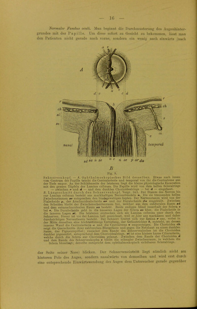 Normaler Fundus oculi. Man beginnt die Durchmusterung de« Augenhinter- grundes mit der Papille. Um diese sofort zu Gesicht zu bekommen, lässt man den Patienten nicht gerade nacli vorne, sondern ein wenig nach einwärts (nacli a V nasal sa 11 se a V n se p ar^ti Fig. 9. Selinerveukopf. — A. Ophthalmoskopisclies Bild desselben. Etwas nach innen vom Centrum der Papille taucht die Centraiarterie und temporal von ihr die Centraivene ans der Tiefe empor. An der Schläfenseite der letzteren liegt die kleine physiologische Excavation mit den grauen Tüpfeln der Lamina cribrosa. Die Papille wird von dem hellen Scleralringe — zwischen n und d — und dem dunklen Chorioidealringe — bei d — eingefasst. B. Längsschnitt durch den Sehnervenkopf. Vergr. 14/1. Der Stamm des Nerven bis zur Lamina cribrosa besteht aus markhaltigen Nervenbündeln n. Die sie trennenden hellen Zwischenräumen se entsprechen den bindegewebigen Septen. Der Nervenstamm wird von der Piaischeide p, der Arachnoidealscheide ar und der Duralscheide du eingehüllt. Zwischen den Scheiden bleibt der Zwischenscheidenraum frei, welcher aus dem subduraleu Kaum ad und dem snbarachnoidealen Raum aa besteht. Beide endigen blind innerhalb der Sclera « bei e. Die Duralscheide geht in die äusseren Lagen der Sclera ao über, die Piaischeide in die inneren Lagen ai. Die letzteren erstrecken sich als Lamina cribrosa quer durch den Sehnerven. Dieser ist vor der Lamina hell gezeichnet, weil er hier aus marklosen und daher durchsichtigen Nervenfasern besteht. Der Sehnerv breitet sich zur Retina r aus, wobei lu der Mitte desselben eine trichtertörniige Vertiefung, der Gefässtrichter b, entsteht, an dessen innerer Wand die Centraiarterie »». und die Centraivene v emporsteigen. Die Chonoidea cfc zeigt die Querschnitte ihrer zahlreichen Blutgefässe und gegen die Netzhaut zu einen dunklen Saum, das Pigmentepithel; zunächst dem Rande des Sebnerveuloches ist die Cliorioidea dunkler pigmentirt, entsprechend dem Chorioidealringe. ei ist eine hintere kurze Ciliararterie, welche durch die Sclera zur Cliorioidea gelangt. Zwischen dem Rande der Chorioidea d und dem Rande des Selinervenkopfes o bleibt ein schmaler Zwischenraum, in welchem die Sclera blossliegt; derselbe entspricht dem ophthalmoskopisch sichtbaren Scleralringe. der Seite seiner Nase) blicken. JJer .Selinerveneintritt liegt nämlich nicht am hinteren Pole des Anges, sondern nasalwärts von demselben und wird erst durch eine entspre(;hendo Einwärtswendmig des Auges dem Untersucher gerade gegenüber