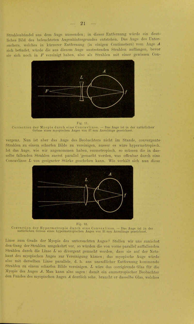 StKvhlenbündel aus dem Auge aussenden; in dieser Entfernung würde ein deut- liches Bild des beleuchteten Augenhintergrundes entstehen. Das Auge des Unter- suchers, welches in kürzerer Entfernung (in einigen Centimetern) vom Auge Ä sich befindet, würde die aus diesem Auge austretenden Strahlen auffangen, bevor sie sich noch in F vereinigt haben, also als Strahlen mit einer gewissen Con- Fig. 11. Correction der Myopie durch eine Concavlinse. — Das Auge ist in der natürliclien' Grösse eines myopischen Auges von 27 mm Axenlänge gezeichnet. vergenz. Nun ist aber das Auge des Beobachters nicht im Stande, convergen.te' Strahlen zu einem scharfen Bilde zu vereinigen, ausser es w^äre hypermetropisch. Ist das Auge, wie wir angenommen haben, emmetropisch, so müssen die in das- selbe fallenden Strahlen zuerst parallel '^gemacht werden, was offenbar durch eine Concavlinse L von geeigneter Stärke geschehen kann. Wie verhält sich nun diese Fig. 12. Correction der Hyperraetropie durch eine Convexllnse. — Das Auge ist in der natürlichen Grösse eines hypermetropischen Auges von 21 mm Axenlänge gezeichnet. Linse zum Grade der Myopie des untersuchten Auges? Stellen wir uns zunächst den Gang der Strahlen umgekehrt vor, so würden die von vorne parallel'auffallenden Strahlen durch die Linse L so divergent gemacht werden, dass sie auf der Netz- haut des myopischen Auges zur Vereinigung kämen; das myopische Auge würde also mit derselben Linse parallele, d. h. aus unendlicher Entfernung kommende Strahlen zu einem scliarfen Bilde vereinigen. L wäre das corrigirende Glas für die Myopie des Auges A. Man kann also sagen: damit ein emmetropischer Beobachter den Fundes des myopischen Auges A deutlich sehe, braucht er dasselbe Glas, welches