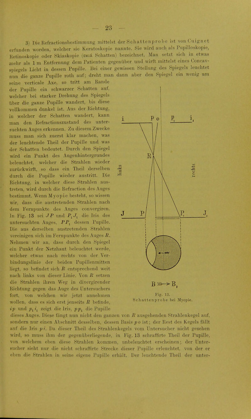 S) Die Kefractionsbcstiininung mittelst der Scliattenprobc ist von Cuignet erfunden worden, welclier sie Keratoskopie nannte, Sie wird auch als Pupilloskopie, Retiuoskopie oder Skiaskopie (axiä Schatten) bezeichnet. Man setzt sich in etwas mehr als 1 m Entfernung dem Patienten gegenüber und wirft, mittelst eines ('oncav- spiegels Licht in dessen Pupille. Bei einer gewissen Stellung des Spiegels leuchtet nun die ganze Pupille roth auf; dreht man dann aber den seine verticale Axe, so tritt am Rande der Pupille ein scJiwarzer Schatten auf, welcher bei starker Drehung des Spiegels über die ganze Pupille wandert, bis diese vollkommen dunkel ist. Aus der Richtung, in welcher der Schatten wandert, kann man den Refractionszustand des unter- suchten Auges erkennen. Zu diesem Zwecke muss man sich zuerst klar machen, was der leuchtende Theil der Pupille und was der Schatten bedeutet. Durch den Spiegel wird ein Punkt des Augenhintergrundes beleuchtet, welcher die Strahlen wieder zurückwirft, so dass ein Theil derselben durch die Pupille wieder austritt. Die Richtung, in welcher diese Strahlen aus- treten, wird durch die Refraction des Auges bestimmt. Wenn Myopie besteht, so wissen wir, dass die austretenden Strahlen nach dem Femxjunkte des Auges convergiren. In Fig. 13 sei JP \md P^J^ die Iris des untersuchten Aiiges, PPj dessen Pupille. Die aus derselben austretenden Strahlen vereinigen sich im Fernpunkte des Auges R. Nehmen wir an, dass durch den Spiegel ein Punkt der Netzhaut beleuchtet werde, welcher etwas nach rechts von der Ver- bindungslinie der beiden Pupillenmitten liegt, so befindet sich R entsprechend weit nach links von dieser Linie. Von R setzen die Strahlen ihren Weg in divergirender Richtung gegen das Auge des Untersuchers fort, von welchen wir jetzt annehmen wollen, dass es sich erst jenseits R befinde, ip und ^j/j zeigt die Iris, pp^ die Pupille dieses Auges. Diese fängt nun nicht den ganzen von R ausgehenden Strahlenkegel auf, sondern nur einen Abschnitt desselben, dessen Basisist; der Rest des Kegels fällt auf die Iris pi. Da dieser Theil des Strahlenkegels vom Untersucher nicht gesehen wird, so muss ihm der gegenüberliegende, in Fig. 13 schraffirte Theil der Pupille, von welchem eben diese Strahlen konnnen, imbeleiichtet erscheinen; der Unter- Bucher sieht nur die nicht schraffirte Strecke dieser Pupille erleuchtet, von der er eben die Strahlen in seine eigene Pupille erhält. Der leuchtende Theil der unter- B »>->B, Fig. i;). Schattenprobe bei Myopie.