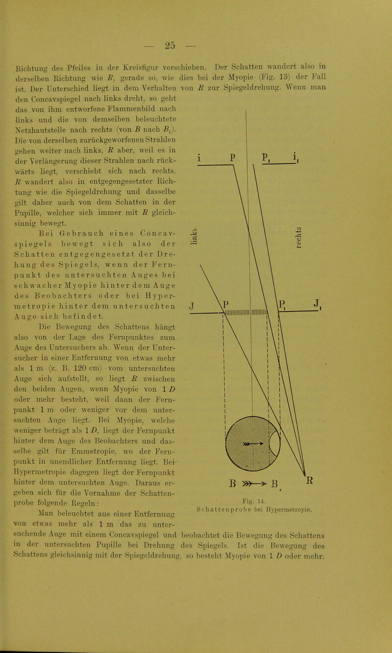 Kichtung des Pfeiles in der Kreisfigur verschieben. Der Schatten wandert also in derselben Kichtung wie B, gerade so, wie dies bei der Myopie (Fig. 13) der Fall ist. Der Unterschied liegt in dem Verhalten von B zur Spiegeldrehung. Wenn man den Concavspiegel nach links dreht, so geht das von ihm entworfene Flanimenbild nach links und die von demselben beleuchtete Netzhautstelle nach rechts (von B nach ß,). Die von derselben zurückgeworfenen Strahlen gehen weiter nach links, B aber, weil es in der Verlängerung dieser Strahlen nach rück- wärts liegt, verschiebt sich nach rechts. B wandert also in entgegengesetzter Rich- tung wie die Spiegeldrehung und dasselbe »ilt daher auch von dem Schatten in der Pupille, welcher sich immer mit B gleich- sinnig bewegt. Bei Gebrauch eines Concav- spiegels bewegt sich also der Schatten entgegengesetzt der Dre- hung des Spiegels, vrenn der Feru- punkt des untersuchten Auges bei schwacher Myopie hinter demAuge des Beobachters oder bei Hyper- metropie hinter dem untersuchten Auge sich befindet. Die Bewegung des Schattens hängt also von der Lage des Fernpunktes zum . Auge des Untersuchers ab. Wenn der Unter- sucher in einer Entfernung von etwas mehr als 1 m (z. B. 120 cm) vom untersuchten Auge sich aufstellt, so liegt B zwischen den beiden Augen, wenn Myopie von 1 D oder mehr besteht, weil dann der Fern- punkt 1 m oder weniger vor dem unter- suchten Auge liegt. Bei Myopie, welche weniger beträgt als 1 D, liegt der Fernpunkt hinter dem Auge des Beobachters und das- selbe gilt für Emmetropie, wo der Fern- punkt in unendlicher Entfernung liegt. Bei- Hypermetropie dagegen liegt der Fernpunkt hinter dem untersuchten Auge. Daraus er- geben sich für die Vornahme der Schatten- probe folgende Regeln: Man beleuchtet aus einer Entfernung von etwas mehr als 1 m das zu unter- suchende Auge mit einem Concavspiegel und beobachtet die Bewegung des Schattens in der untersuchten Pupille bei Drehung des Spiegels. Ist die Bewegung des Schattens gleichsinnig mit der Spiegeldrehung, so besteht Myopie von 1 D oder mehr. B s^—> B Fig. U. Scliattenprobe bei Hypermetropie.