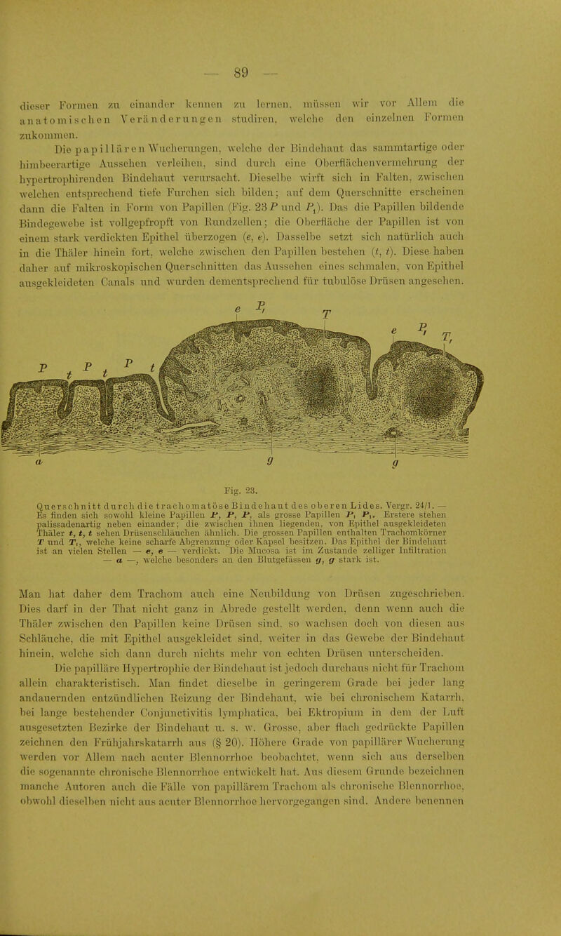 dieser Formen zu einander kennen zu loriion, müssen wir vor Allem die anatomischen Yerii nderungen studiien. welche den einzelnen Formen zukommen. Die papillären Wucherungen, welelie der Bindehaut das sammtartige oder liimbeerartige Aussehen verleihen, sind durch eine Oljerflächenverniehrung der hypertrophirenden Bindehaut verursacht. Dieselbe wirft sich in Falten, zwischen Avelchen entsprechend tiefe Furchen sich bilden; auf dem Querschnitte erscheinen dann die Falten in Form von Papillen (Fig. 23 P und Das die Papillen bildende Bindegewebe ist vollgepfropft von liimdzellen; die Oberfläche der Papillen ist von einem stark verdickten Epithel überzogen (e, t). Dasselbe setzt sicli natürlich auch in die Thäler hinein fort, welche zwischen den Papillen bestehen {t, t). Diese haben daher auf mikroskopischen Querschnitten das Aussehen eines schmalen, von Epithel ausgekleideten Canals und wurden dementsprechend für tubulöse Drüsen angesehen. Fig. 23. Querschnitt durch die trachoniatöse Bindehaut des obereu Lides. Vergr. 24/1. — Es finden sich sowohl kleine Papillen J*, P, i*, als grosse Papillen J», J*,. Erstere stehen palissadenartig neben einander; die zwischen ihnen liegenden, von Epithel ausgekleideten Thäler *, *, * sehen Drüsenschläuchen ähnlich. Die grossen Papillen enthalten Trachomkörner '£ und T,, welche keine scharfe Abgrenz-ung oder Kapsel besitzen. Das Epithel der Bindehaut ist an vielen Stellen — «, e — verdickt. Die Mxicosa ist im Zustande zelliger Infiltration — a —, welche besonders an den Blutgefässen g, g stark ist. Man liat daher dem Trachom auch eine Neubildung von Drüsen zugeschrieben. Dies darf in der That nicht ganz in Abrede gestellt werden, denn wenn auch die Thäler zwischen den Pax^illen keine Drüsen sind, so wachsen doch von diesen aus Schläuche, die mit Epithel ausgekleidet sind, weiter in das Gewebe der Bindehaut hinein, welche sich dann durch nichts mehr von echten Drüsen unterscheiden. Die papilläre Ilyiiertrophie der Bindehaut ist jedoch durchaus nicht für Trachom allein charakteristisch. Man findet dieselbe in geringerem Grade bei jeder lang andauernden entzündlichen Heizung der Bindehaut, w-ie bei chronischem Katarrh, bei lange bestehender Conjunctivitis lymphatica. bei Ektropium in dem der Ijuft ausgesetzten Bezirke der Bindehaut ii. s. w. Grosse, alier flach gedrückte Papillen zeichnen den Frühjalirskatarrh aus (§ 20). Höhere Grade von papillärer Wucherung werden vor Allem nach acuter Blennorrhoe beobachtet, wenn sich aus dei'sell)en die sogenannte chronische Blennorrhoe entwickelt hat. Aus diesem Grunde bezeichnen manche Autoren auch die Fälle von papillärem Trachom als clu'onische Blennorrhoe, ol)wohl dieselben nicht aus acntor Blennorrhoe hervorgegangen sind. Andere benennen