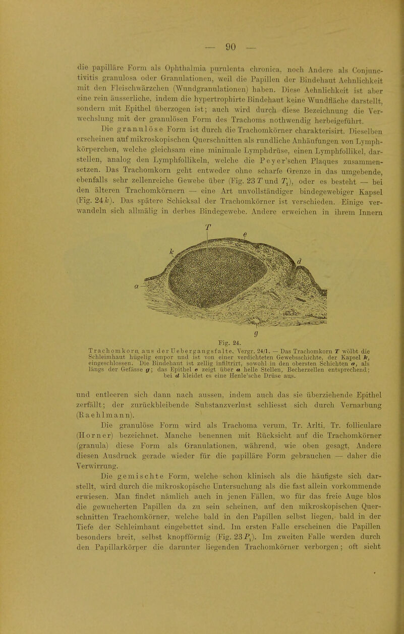 die papilliiro Form als Oiilitlialniia purnlenta chronica, noch Andere als Conjunc- tivitis granulosa oder Granulationen, weil die Papillen der Bindehaut Aehnliclikeit mit den Fleischwärzchen (Wundgrannlationen) haben. Diese Aehnlichkeit ist al)er eine rein äusserliche, indem die hypertrophirte Bindehaut keine Wundfläche darstellt, sondern mit Epithel überzogen ist; auch wird durch diese Bezeichnung die Ver- wechslung mit der granulösen Form des Trachoms nothwendig herbeigeführt. Die granulöse Form ist durch die Trachomkörner charakterisirt. Dieselben erscheinen auf mikroskopischen Querschnitten als rundliche Anhäufungen von Lymph- körperchen, welche gleichsam eine minimale Lymphdrüse, einen LymphfoUikel. dar- stellen, analog den Lymphfollikeln, welche die Peyer'schen Plaques zusammen- setzen. Das Trachomkorn geht entweder ohne scharfe Grenze in das umgebende, ebenfalls sehr zellenreiche Gewebe über (Fig. 23 T und TJ, oder es besteht — bei den älteren Trachomkörnern — eine Art unvollständiger bindegewebiger Kapsel (Fig. 24 Ä;). Das spätere Schicksal der Trachomkörner ist verschieden. Einige ver- wandeln sich allmälig in derbes Bindegewebe. Andere erweichen in ihrem Innern Fig. 24. Trachomkorii. ans der Uebergangsfalte. Vergr. 24/1. — Das Tracliomkorn T wölbt die Schleimhaut hügelig empor und ist von eiuei' verdichteten Gewebsschichte, der Kapsel h, eingeschlossen. Die Bindehaut ist zellig infiltrirt, sowohl in den obersten Schichten a, als längs der Gefiisse g; das Epithel e zeigt über a helle Stelleu, Becherzellen entsprechend; bei d kleidet es eine Henle'sche Drüse aus. und entleeren sich dann nach aussen, indem auch das sie überziehende Epithel zerfällt; der zurückbleibende Substanzverlust schliesst sich durch Vernarbung (Raehlmann). Die granulöse Form wird als Trachoma verum, Tr. Arlti. Tr. folliculare (Horner) bezeichnet. Manche benemien mit Rücksicht auf die Trachomkörner (granula) diese Form als Granulationen, während, wie oben gesagt, Andere diesen Ausdruck gerade wieder für die papilläre Form gebrauchen — daher die Verwirrung. Die gemischte Fomn, welche schon klinisch als die häufigste sich dar- stellt, wird durch die mikroskopische Untersuchung als die fast allein vorkommende erwiesen. Man findet nämlich auch in jenen Fällen, wo für das freie Auge blos die gewucherten Papillen da zu sein scheinen, auf den mikroskopischen Quer- schnitten Trachomkörner, welche bald in den Papillen selbst liegen, bald in der Tiefe der Schleimhaut eingebettet sind. Im ersten Falle erscheinen die Papillen besonders breit, selbst knopfförmig (Fig. 23 PJ. Im zweiten Falle werden durch den Papillarkörper die darunter liegenden Trachomkörner verborgen; oft sieht