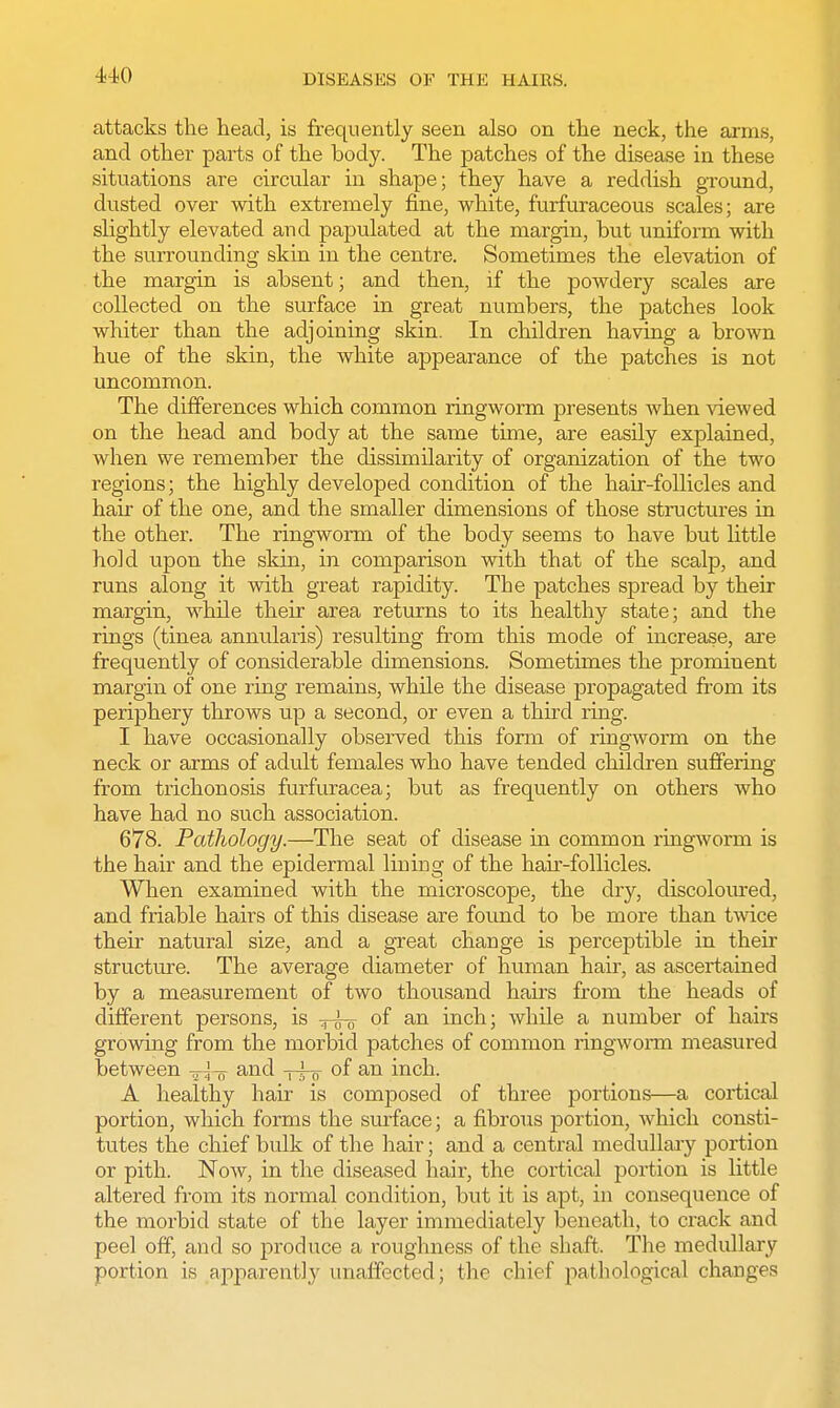 attacks the head, is frequently seen also on the neck, the arms, and other parts of the body. The patches of the disease in these situations are circular in shape; they have a reddish ground, dusted over with extremely fine, white, furfuraceous scales; are slightly elevated and papulated at the margin, but uniform with the surrounding skin in the centre. Sometimes the elevation of the margin is absent; and then, if the powdery scales are collected on the surface in great numbers, the patches look whiter than the adjoining skin. In children having a brown hue of the skin, the white appearance of the patches is not uncommon. The differences which common ringworm presents when viewed on the head and body at the same time, are easily explained, when we remember the dissimilarity of organization of the two regions; the highly developed condition of the hair-follicles and hair of the one, and the smaller dimensions of those structures in the other. The ringworm of the body seems to have but little hold upon the skin, in comparison with that of the scalp, and runs along it with great rapidity. The patches spread by their margin, while their area returns to its healthy state; and the rings (tinea annularis) resulting from this mode of increase, are frequently of considerable dimensions. Sometimes the prominent margin of one ring remains, while the disease propagated from its periphery throws up a second, or even a third ring. I have occasionally observed this form of ringworm on the neck or arms of adult females who have tended children suffering from trichonosis furfuracea; but as frequently on others who have had no such association. 678. Pathology.—The seat of disease in common ringworm is the hair and the epidermal lining of the hair-follicles. When examined with the microscope, the dry, discoloured, and friable hairs of this disease are found to be more than twice their natural size, and a great change is perceptible in their structure. The average diameter of human hair, as ascertained by a measurement of two thousand hairs from the heads of different persons, is q-^o °f an inch; while a number of hairs growing from the morbid patches of common ringworm measured between -^-^ and -j-^- of an inch. A healthy hair is composed of three portions—a cortical portion, which forms the surface; a fibrous portion, which consti- tutes the chief bulk of the hair; and a central medullary portion or pith. Now, in the diseased hair, the cortical portion is little altered from its normal condition, but it is apt, in consequence of the morbid state of the layer immediately beneath, to crack and peel off, and so produce a roughness of the shaft. The medullary portion is apparently unaffected; the chief pathological changes