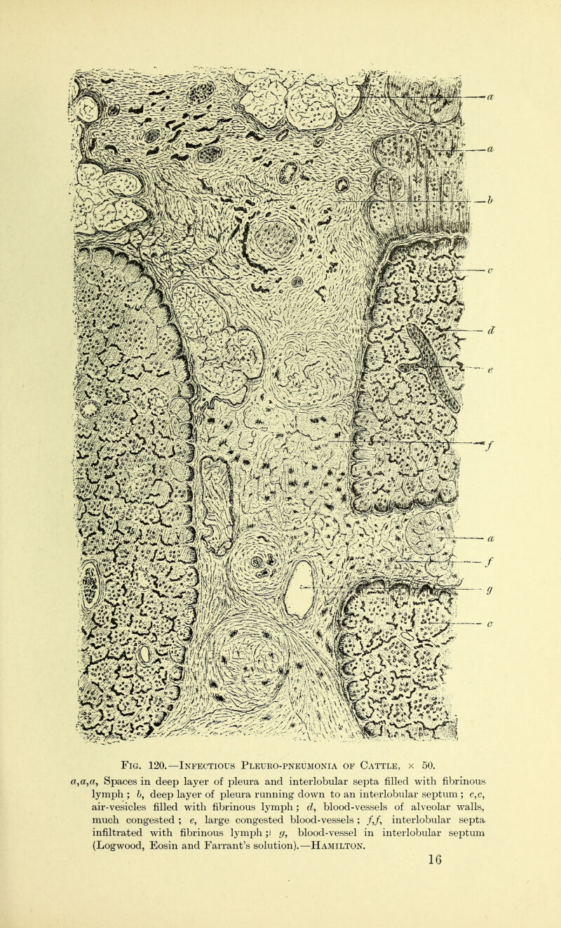 Fig. 120.—Infectious Pleuropneumonia op Cattle, x 50. a,a,a, Spaces in deep layer of pleura and interlobular septa filled with fibrinous lymph ; b, deep layer of pleura running down to an interlobular septum ; c,c, air-vesicles filled with fibrinous lymph; d, blood-vessels of alveolar walls, much congested ; e, large congested blood-vessels ; /,/, intei'lobular septa infiltrated with fibrinous lymph ;i g, blood-vessel in interlobular septum (Logwood, Eosin and Farrant's solution).—Hamilton. 16