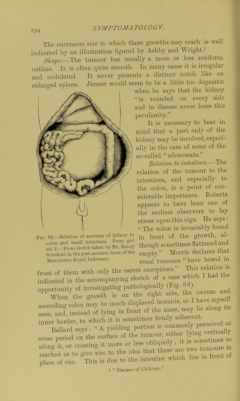 The enormous size to which these growths may reach is well indicated by an illustration figured by Ashby and Wright.^ Shape. The tumour has usually a more or less reniform outline. It is often quite smooth. In many cases it is irregular and nodulated. It never presents a distinct notch like an enlarc^ed spleen. Jenner would seem to be a little too dogmatic ° when he says that the kidney is rounded on every side and in disease never loses this peculiarity. It is necessary to bear in mind that a part only of the kidney may be involved, especi- ally in the case of some of the so-called  adenomata. Relation to intestines.—The relation of the tumour to the intestines, and especially to the colon, is a point of con- siderable importance. Eoberts appears to have been one of the earliest observers to lay stress upon this sign. He says :  The colon is invariably found Fig 88.-Eelation of sarcoma of kidney to -^^ j^q^^^. ^J^e grOWth, al- S\°rp:„rSr.y M though sometimes Sattened and Sciiotieid in the post-mortem room of the empty. Moms declares that Manchester Eoyal Infirmary. xensl tumOUrS  have boWCl in front of them with only the west exceptions. ™s -lotion is indicated in the accompanying sketch o a case wh ch I had the ODDortunity of investigating pathologically (l)g. bb). When the growth is on the right side, the c«cum and ascendrt colon may be much displaced inwards, as I -ve mys « Tn and. instead of lying in front of the mass, may he along Its i„T,er border to which it is sometimes firmly adherent.  ClrlUs: A yielding portion is —^.^'^'^^^ some neriod on the surface of the tumour, either ymg ^^''^''^ aZ/it o. crossing it more or less obliquely; it is sometmies s^ maSed as to ge ' se to the idea that there are two tumour in place of one. 'tUs is due to the intestine which lies in front of 1 Diseases of Children.