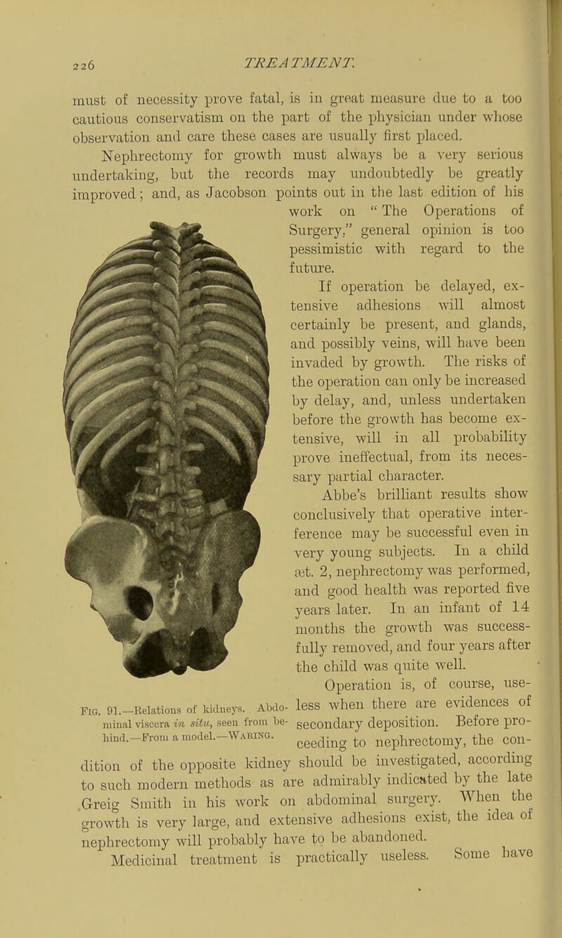 must of necessity prove fatal, is iu great measure due to a too cautious conservatism on the part of the physician under whose observation and care these cases are usually first placed. Nephrectomy for growth must always be a very serious undertaking, but the records may undoubtedly be greatly improved; and, as Jacobson points out in the last edition of his work on  The Operations of Surgery. general opinion is too pessimistic with regard to the future. If operation be delayed, ex- tensive adhesions will almost certainly be present, and glands, and possibly veins, will have been invaded by growth. The risks of the operation can only be increased by delay, and, unless undertaken before the growth has become ex- tensive, will in all probabiUty prove ineffectual, from its neces- sary partial character. Abbe's brilhant results show conclusively that operative inter- ference may be successful even in very young subjects. In a child ;\jt. 2, nephrectomy was performed, ■ '^^ ^00^ health was reported five VJPS^B  1^^'^^ -^^ infant of 14 months the growth was suceess- ^^^^^'^■^ fully removed, and four years after the child was quite well. Operation is, of course, use- FiG. 9i.-Reiatious of kidneys. Abdo- Icss whou there are evidences of niiuai viscura in situ, seen from be- secondary deposition. Before pro- hind.-Froni a model.-WAi.iNG. ^^^^^-^^g nephrectomy, the con- dition of the opposite kidney should be investigated, according to such modern methods as are admirably indicnted by the late .Greig Smith in his work on abdominal surgery. AVhen the growth is very large, and extensive adhesions exist, the idea of nephrectomy will probably have to be abandoned. Medicinal treatment is practically useless. Some have