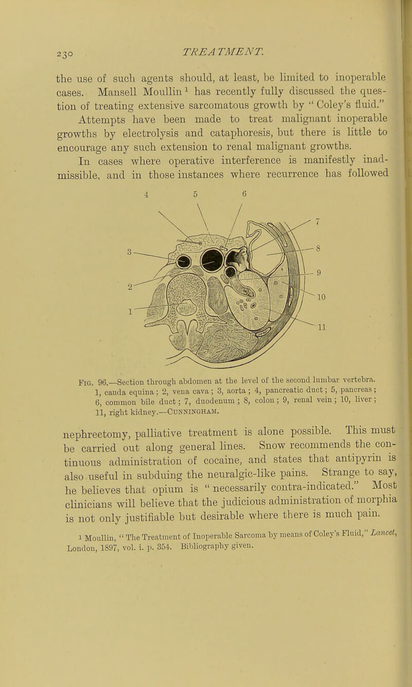 the use of such agents should, at least, be Umited to inoperable cases. Mansell Moullm ^ has recently fully discussed the ques- tion of treating extensive sarcomatous growth by Coley's fluid. Attempts have been made to treat malignant inoperable growths by electrolysis and cataphoresis, but there is little to encourage any such extension to renal malignant growths. In cases where operative interference is manifestly inad- missible, and in those instances where recurrence has followed 4 5 6 Fig. 96.—Section through abdomen at the level of the second lumbar vertebra. I, Cauda equina ; 2, vena cava ; 3, aorta ; 4, pancreatic duct; 5, pancreas ; 6, common bile duct; 7, duodenum ; 8, colon; 9, renal vein; 10, liver; II, right kiduey.—Cunningham. nephrectomy, palliative treatment is alone possible. This must be carried out along general lines. Snow recommends the con- tinuous administration of cocaine, and states that antipyrin is also useful in subduing the neuralgic-like pains. Strange to say, he believes that opium is necessarily contra-indicated. Most clinicians will believe that the judicious administration of morphia is not only justifiable but desirable where there is much pain. 1 Moullin, The Treatment of Inoperable Sarcoma by means of Coley's Fluid, Lancet, London, 1897, vol. i. p. 354. Bibliography giveu.
