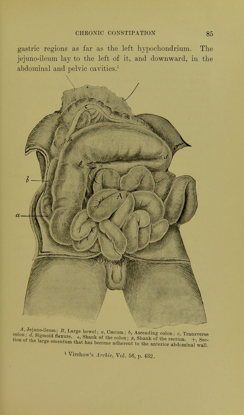 gastric regions as far as the left hypochondrium. The jejnno-ileuni lay to the left of it, and downward, in the abdominal and pelvic cavities.\ \ •■'J colol^'fsTg'Sefure' S' ?V^^'T= ^f-^ing'colon; o, Transverse tion nf f ho 1 e^ure. a, Shank of the colon; p, Shank of the rectum + Spp tion of the large omentum that has become adherent to the • ' anterior abdominal wall. ^ Virchow's ArcMv, Vol. 56, p. 432.