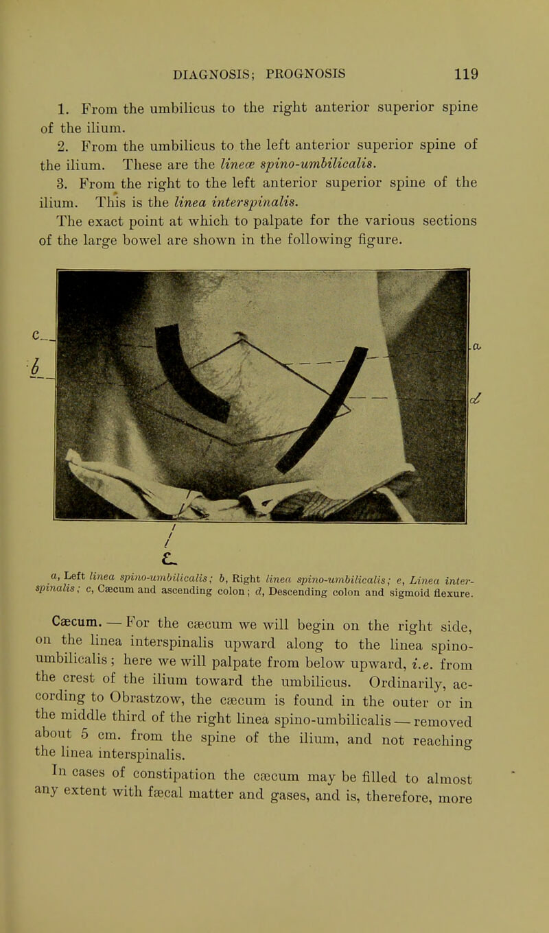 1. From the umbilicus to the right anterior superior spine of the ilium. 2. From the umbilicus to the left anterior superior spine of the ilium. These are the Unece spino-umbilicalis. 3. From the right to the left anterior superior spine of the ilium. This is the linea inter spinalis. The exact point at which to palpate for the various sections of the large bowel are shown in the following figure. a, Left linea spino-umbilicalis; b, Right linea spino-umbilicalis; e, Linea inter- sptnalis; c, Csecum and ascending colon; d, Descending colon and sigmoid flexure. Caecum. — For the csecum we will begin on the right side, on the linea interspinalis upward along to the linea spino- umbilicalis ; here we will palpate from below upward, i.e. from the crest of the ilium toward the umbilicus. Ordinarily, ac- cording to Obrastzow, the csecum is found in the outer or in the middle third of the right linea spino-umbilicalis — removed about 5 cm. from the spine of the ilium, and not reaching the linea interspinalis. In cases of constipation the csecum may be filled to almost any extent with fsecal matter and gases, and is, therefore, more