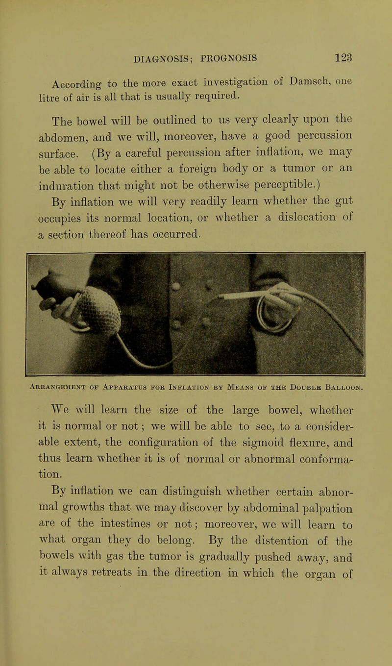 According to the more exact investigation of Damsch, one litre of air is all that is usually required. The bowel will be outlined to us very clearly upon the abdomen, and we will, moreover, have a good percussion surface. (By a careful percussion after inflation, we may be able to locate either a foreign body or a tumor or an induration that might not be otherwise perceptible.) By inflation we will very readily learn whether the gut occupies its normal location, or whether a dislocation of a section thereof has occurred. Arrangement of Apparatus fob Inflation by Means of the Double Balloon. We will learn the size of the large bowel, whether it is normal or not; we will be able to see, to a consider- able extent, the configuration of the sigmoid flexure, and thus learn whether it is of normal or abnormal conforma- tion. By inflation we can distinguish whether certain abnor- mal growths that we may discover by abdominal palpation are of the intestines or not; moreover, we will learn to what organ they do belong. By the distention of the bowels with gas the tumor is gradually pushed away, and it always retreats in the direction in which the organ of