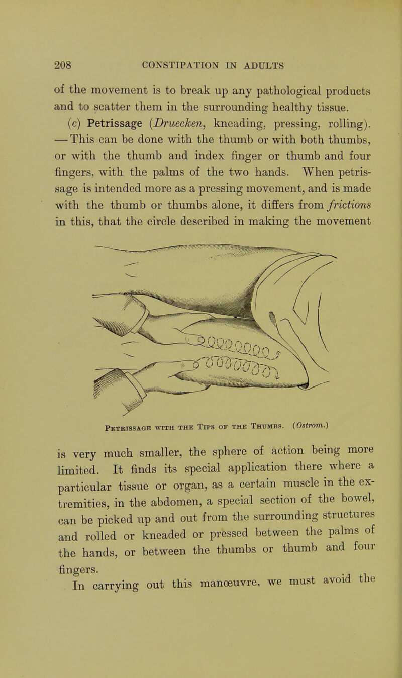 of the movement is to break up any pathological products and to scatter them in the surrounding healthy tissue. (c) Petrissage {Druecken, kneading, pressing, rolling). — This can be done with the thumb or with both thumbs, or with the thumb and index finger or thumb and four fingers, with the palms of the two hands. When petris- sage is intended more as a pressing movement, and is made with the thumb or thumbs alone, it differs from frictions in this, that the circle described in making the movement Petrissage with the Tips of the Thumbs. (Ostrom.) is very much smaller, the sphere of action being more limited. It finds its special application there where a particular tissue or organ, as a certain muscle in the ex- tremities, in the abdomen, a special section of the bowel, can be picked up and out from the surrounding structures and rolled or kneaded or pressed between the palms of the hands, or between the thumbs or thumb and four fingers. In carrying out this manoeuvre, we must avoid the