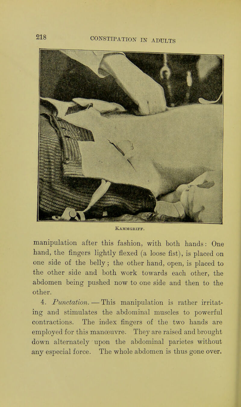 Kammgriff. manipulation after this fashion, with both hands: One hand, the fingers lightly flexed (a loose fist), is placed on one side of the belly; the other hand, open, is placed to the other side and both work towards each other, the abdomen being pushed now to one side and then to the other. 4. Punctation.—This manipulation is rather irritat- ing and stimulates the abdominal muscles to powerful contractions. The index fingers of the two hands are employed for this manoeuvre. They are raised and brought down alternately upon the abdominal parietes without any especial force. The whole abdomen is thus gone over.