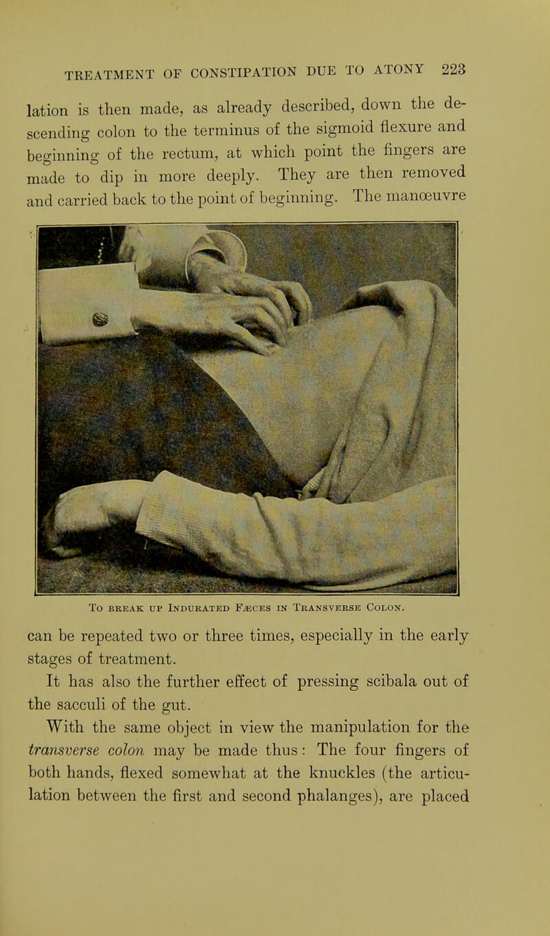 lation is then made, as already described, down the de- scending colon to the terminus of the sigmoid flexure and beginning of the rectum, at which point the fingers are made to dip in more deeply. They are then removed and carried back to the point of beginning. The manoeuvre To BREAK UP iNDUKATED F^CES IN TbANSVERSB COLON. can be repeated two or three times, especially in the early stages of treatment. It has also the further effect of pressing scibala out of the sacculi of the gut. With the same object in view the manipulation for the transverse colon may be made thus: The four fingers of both hands, flexed somewhat at the knuckles (the articu- lation between the first and second phalanges), are placed