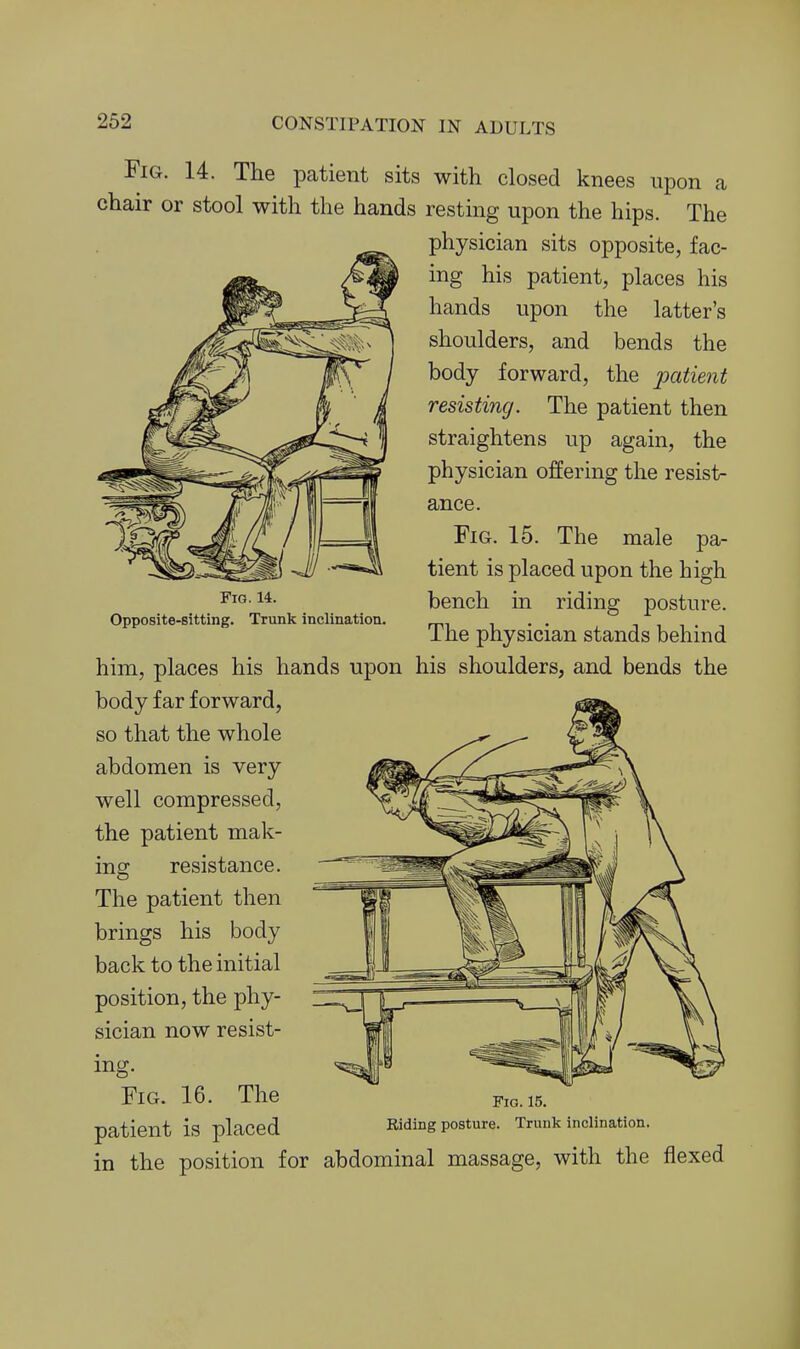Fig. 14. The patient sits with closed knees upon a chair or stool with the hands resting upon the hips. The physician sits opposite, fac- ing his patient, places his hands upon the latter's shoulders, and bends the body forward, the patient resisting. The patient then straightens up again, the physician offering the resist- ance. Fig. 15. The male pa- tient is placed upon the high bench in riding posture. The physician stands behind him, places his hands upon his shoulders, and bends the body far forward, so that the whole abdomen is very well compressed, the patient mak- ing; resistance. The patient then brings his body back to the initial position, the phy- sician now resist- FiG. 14. Opposite-sitting. Trunk inclination. mg. Fig. 16. The patient is placed in the position for abdominal massage, with the flexed Fig. 15. Riding posture. Trunk inclination.