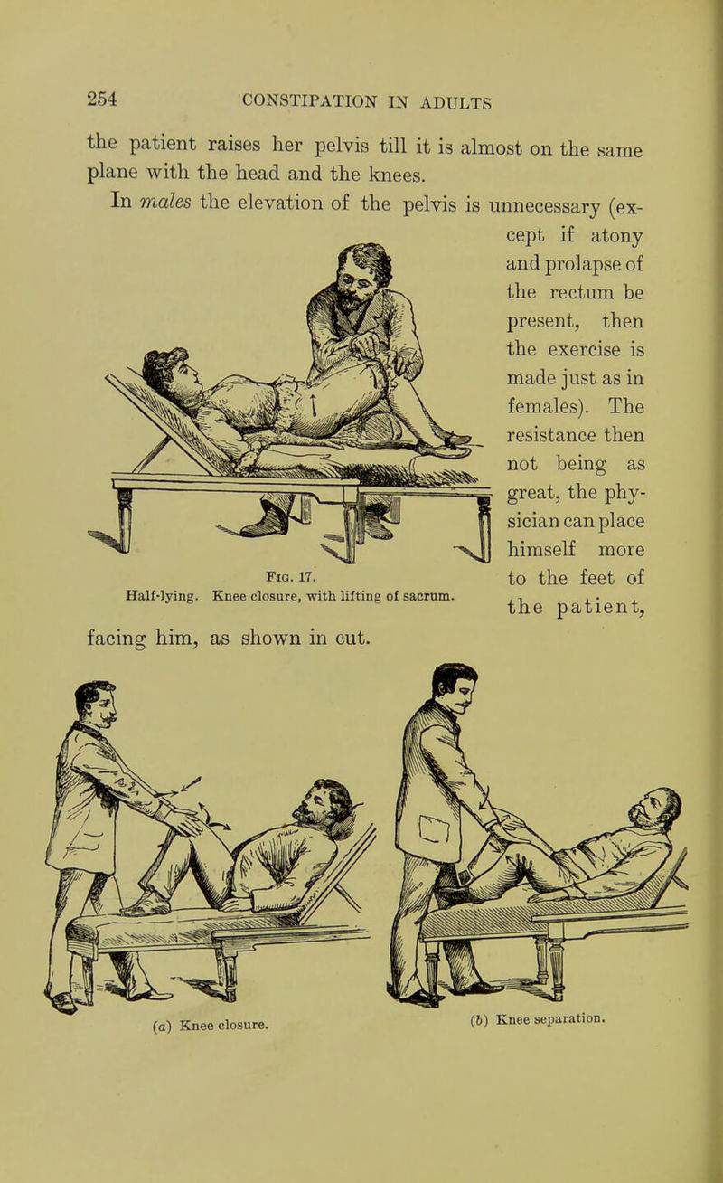 the patient raises her pelvis till it is almost on the same plane with the head and the knees. In males the elevation of the pelvis is unnecessary (ex- cept if atony and prolapse of the rectum be present, then the exercise is made just as in females). The resistance then not being as great, the phy- sician can place himself more Fig. 17. to the feet of Half-lying. Knee closure, with lifting of sacrum. , , , . the patient, facing him, as shown in cut. (a) Knee closure. (6) Knee separation.